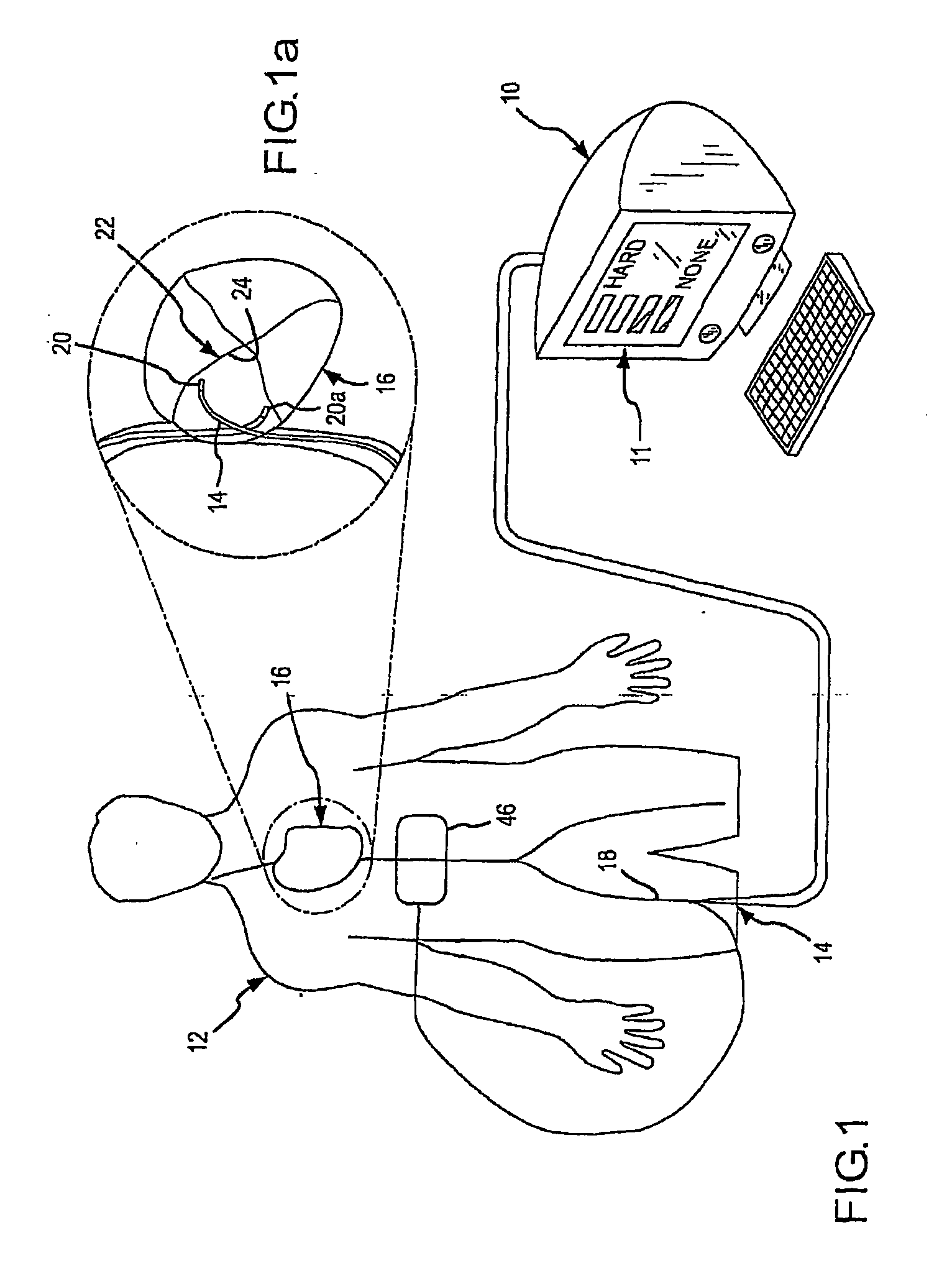 Assessment of electrode coupling for tissue ablation