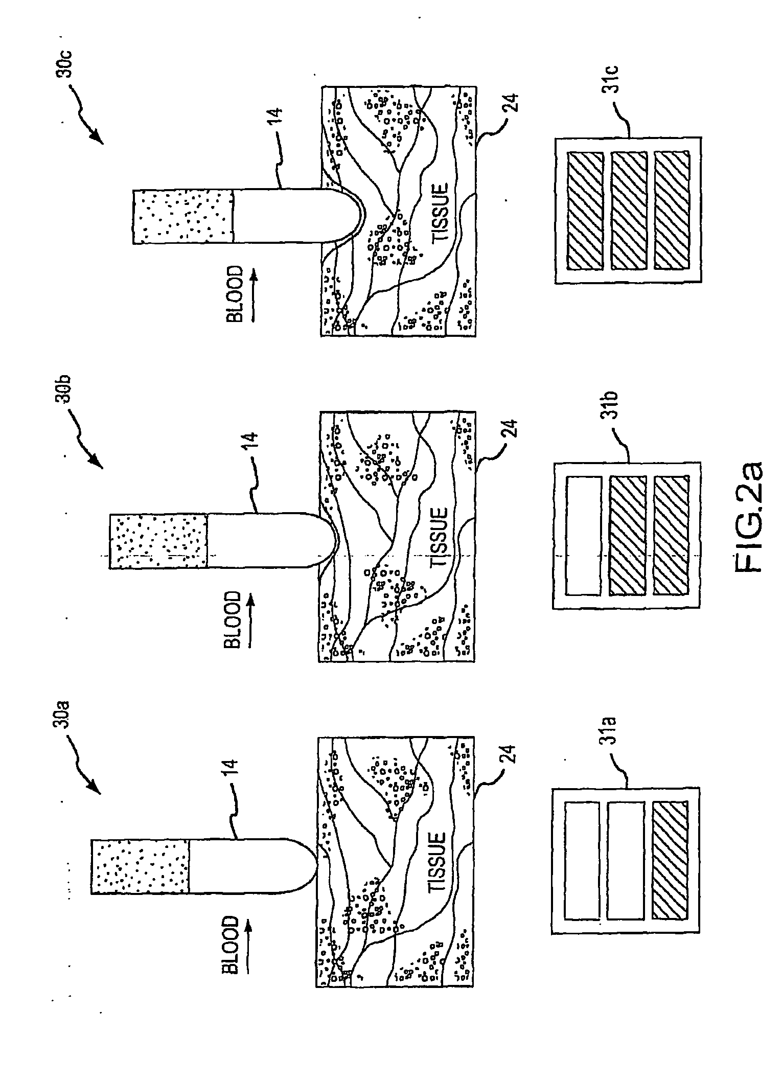 Assessment of electrode coupling for tissue ablation