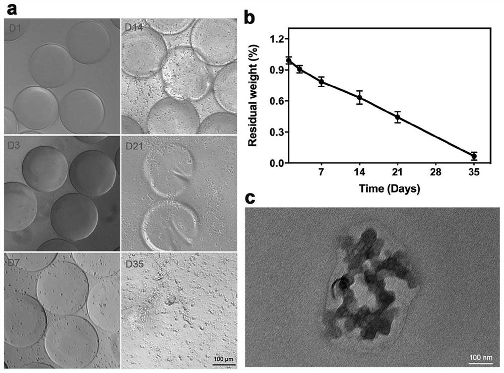 Injectable hydrogel microsphere for treating orthopedic diseases as well as preparation method and application thereof