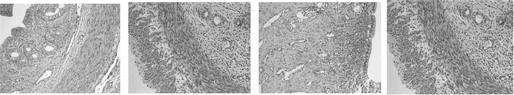 Application of combination of heat-clearing traditional Chinese medicinal composition and antibiotic in preparation of uterus disease treatment drugs