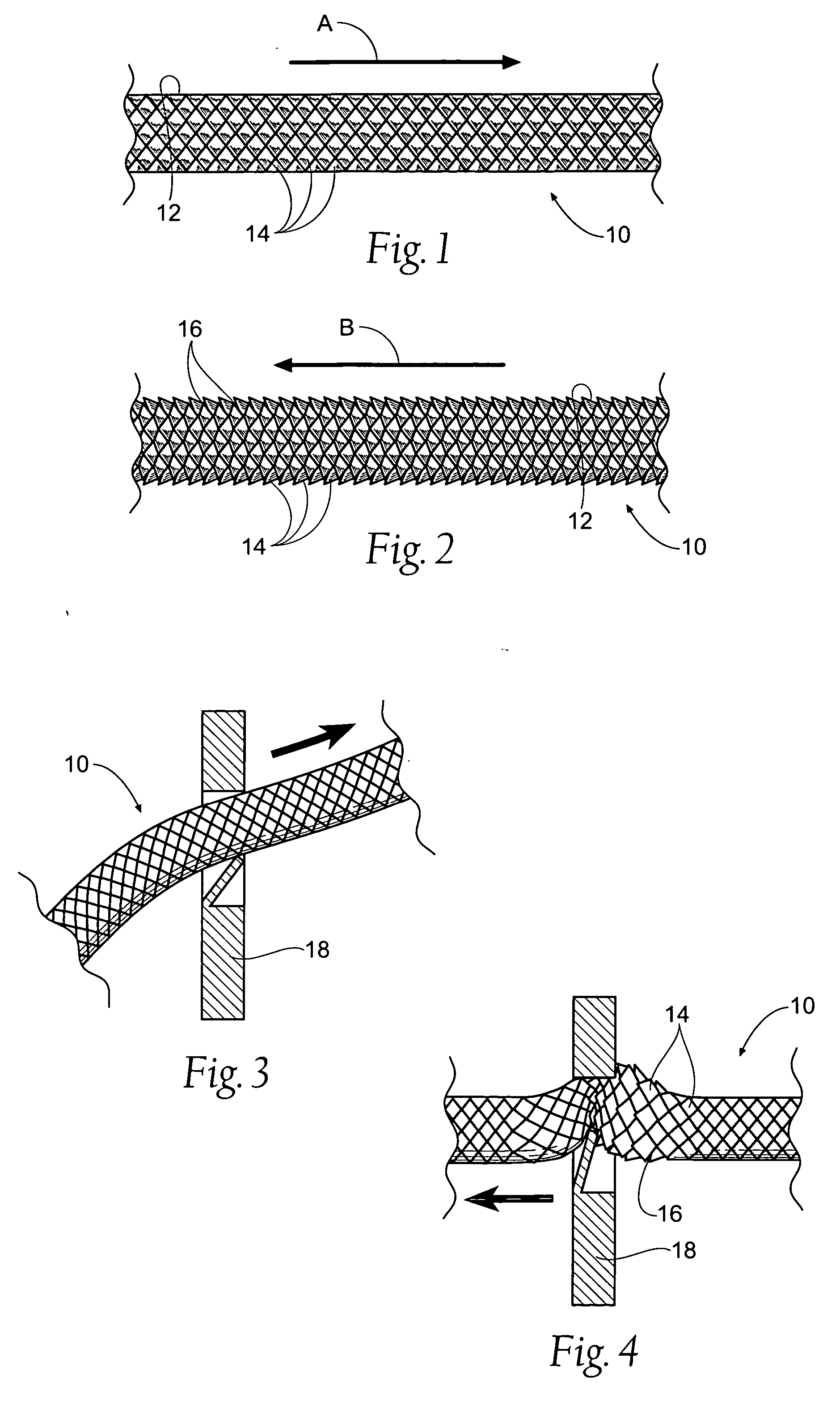 Scaled suture thread