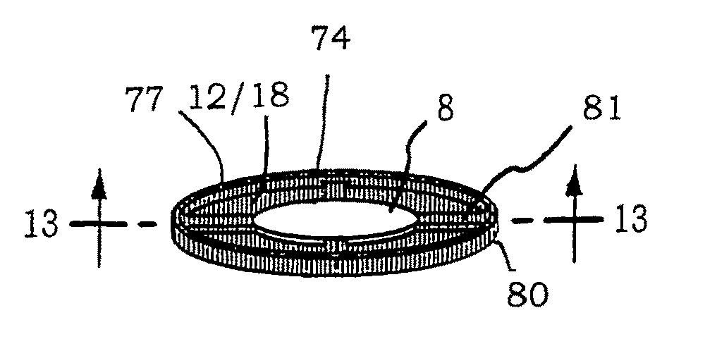 Intraocular implant cell migration inhibition system