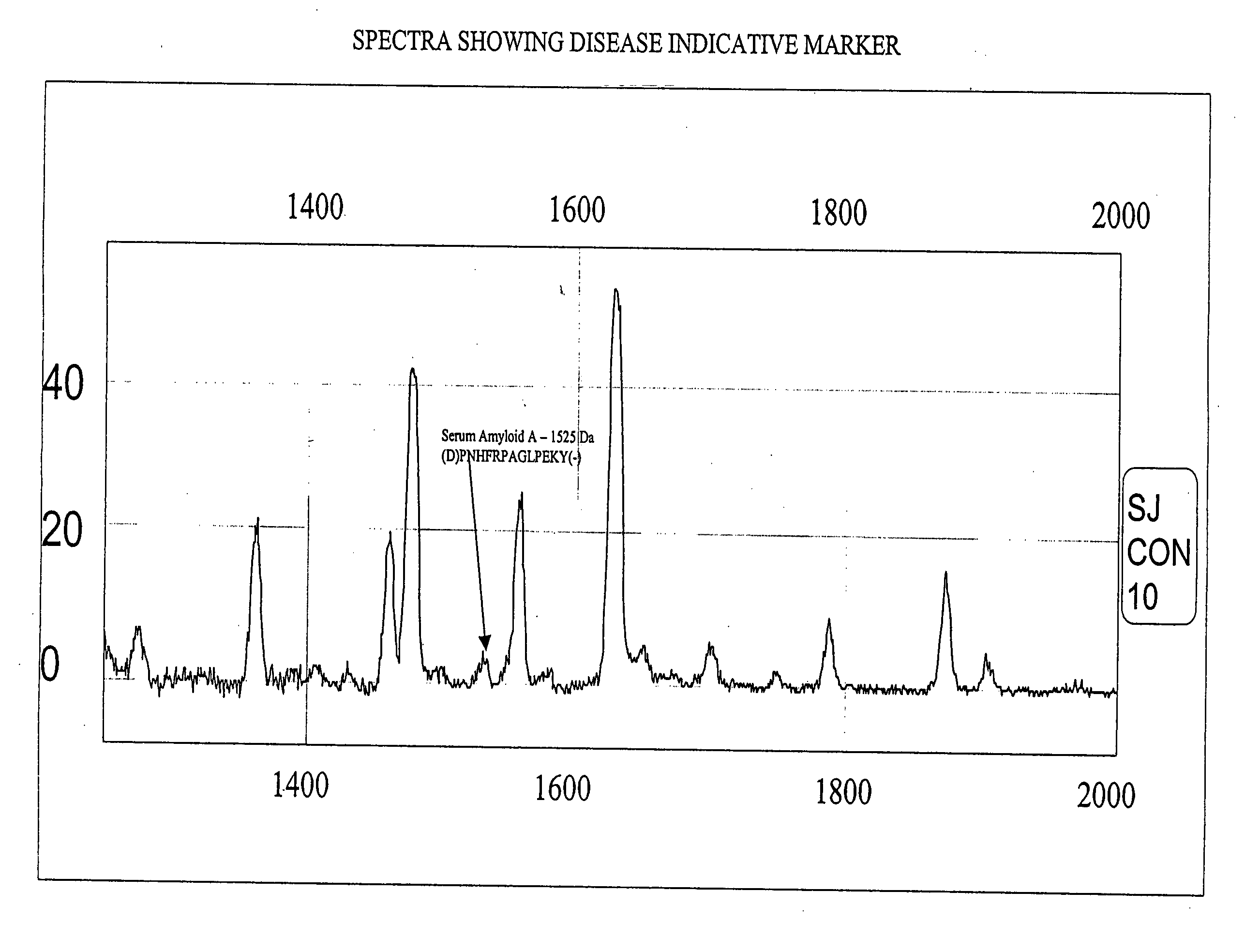 Biopolymer marker indicative of disease state having a molecular weight of 1525 daltons