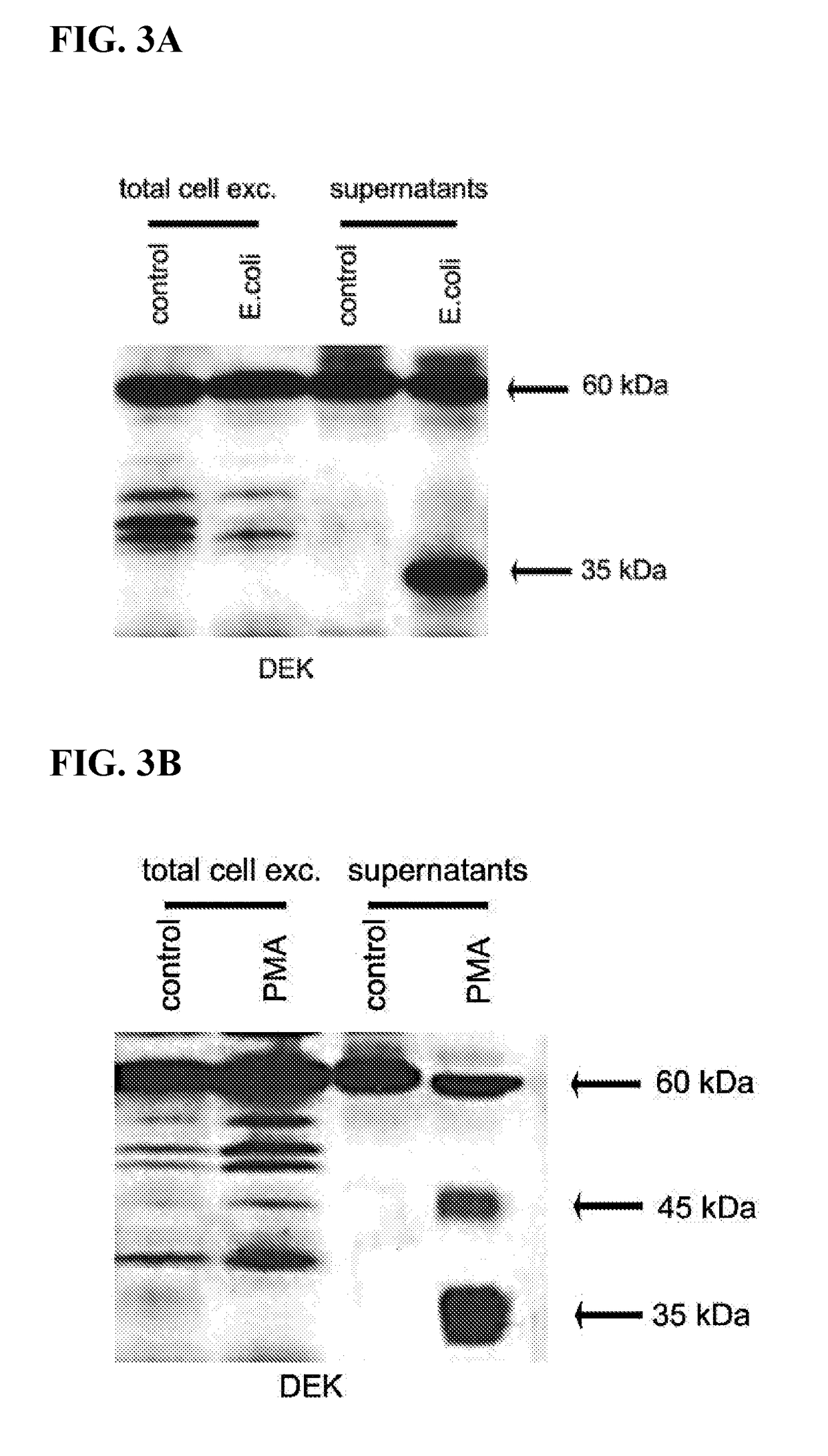 Inhibitors of dek protein and related methods