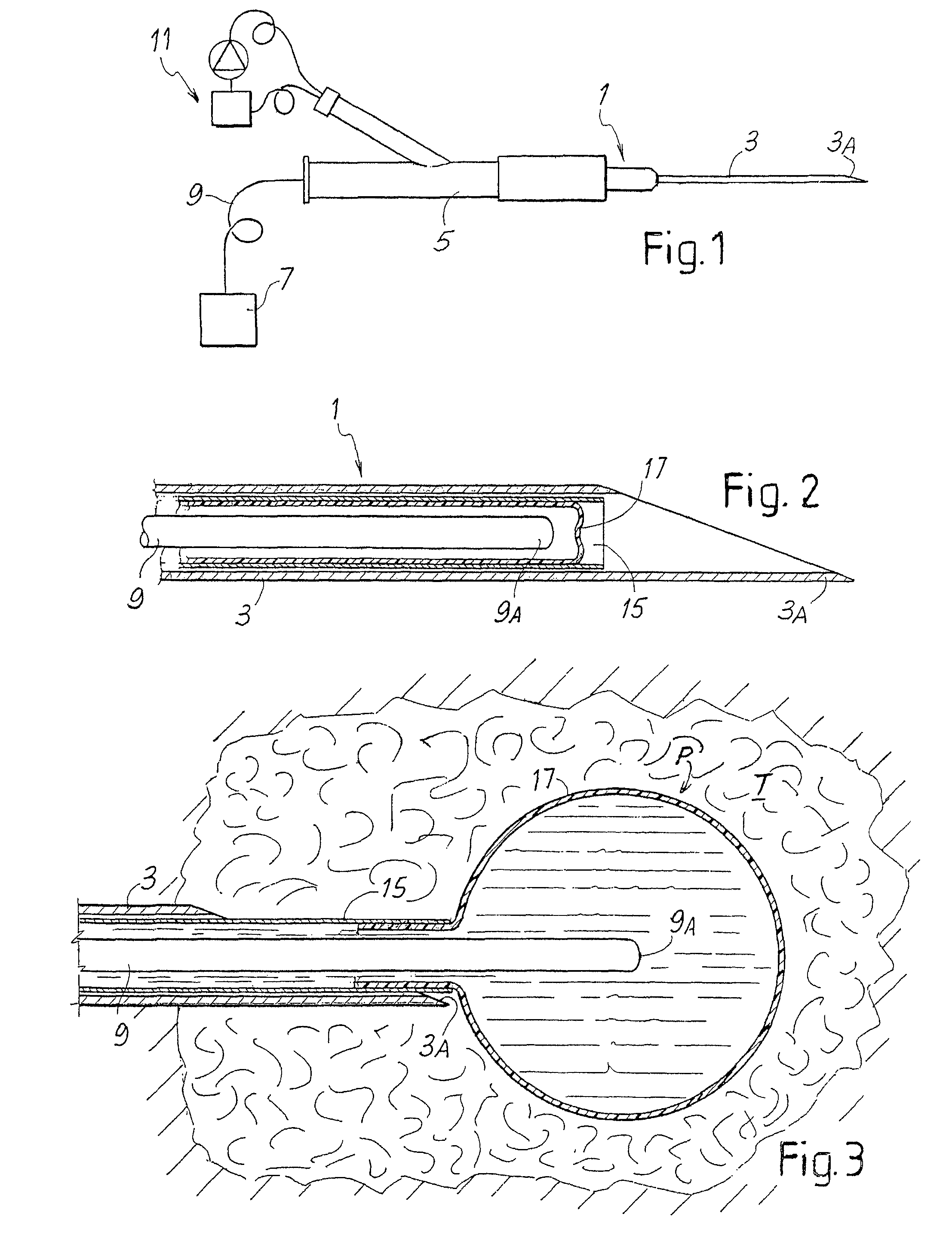 Device and equipment for treating tumors by laser thermotherapy