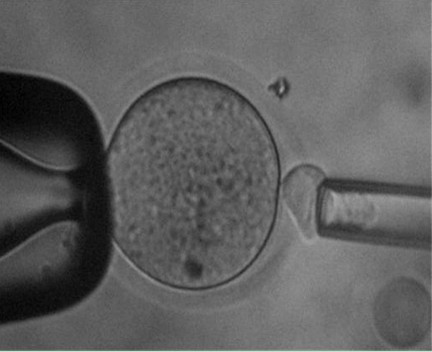 Method for removing mouse oocyte nuclei by adopting zona pellucida solution cavity method