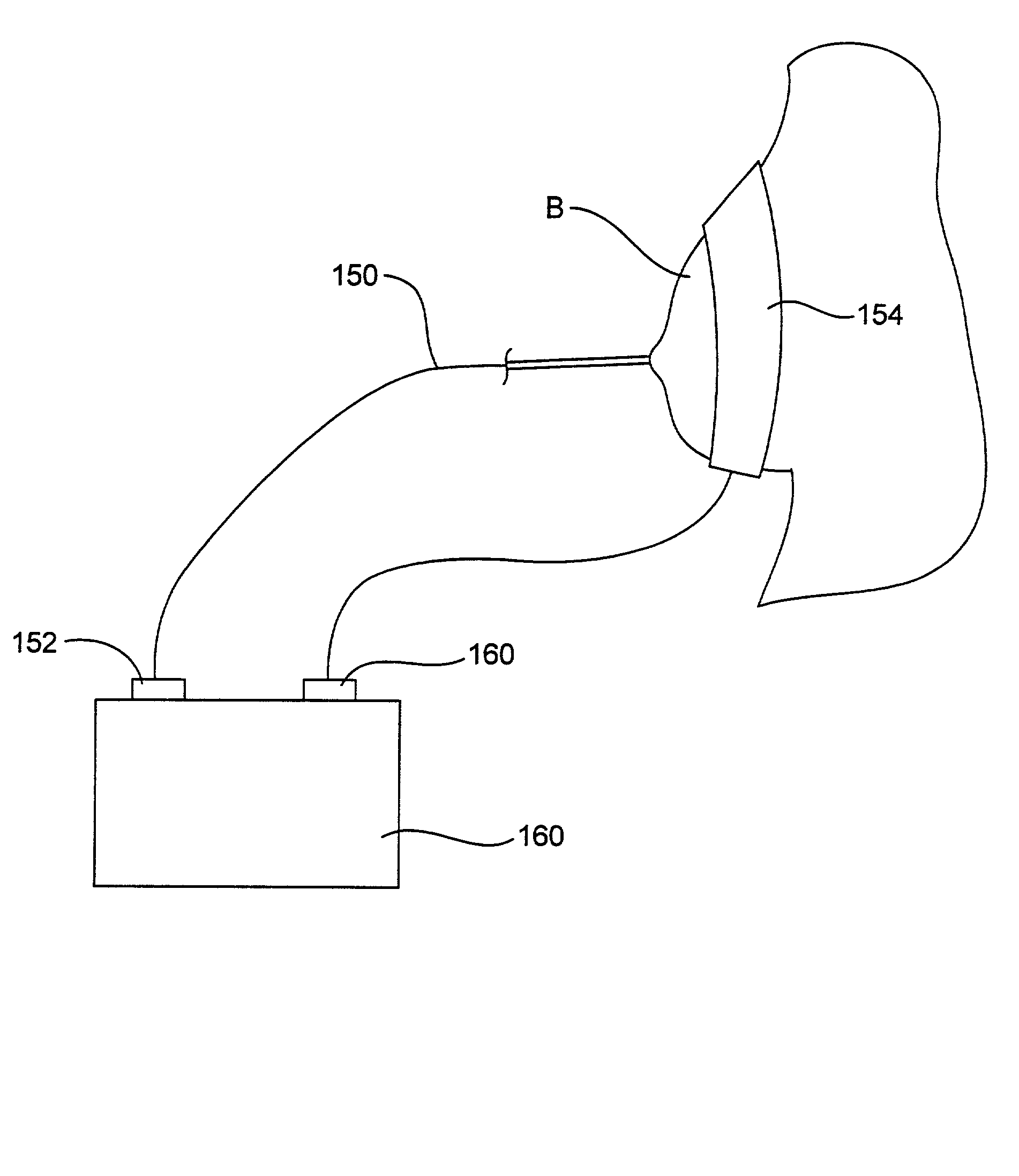 Methods and systems for treating breast tissue