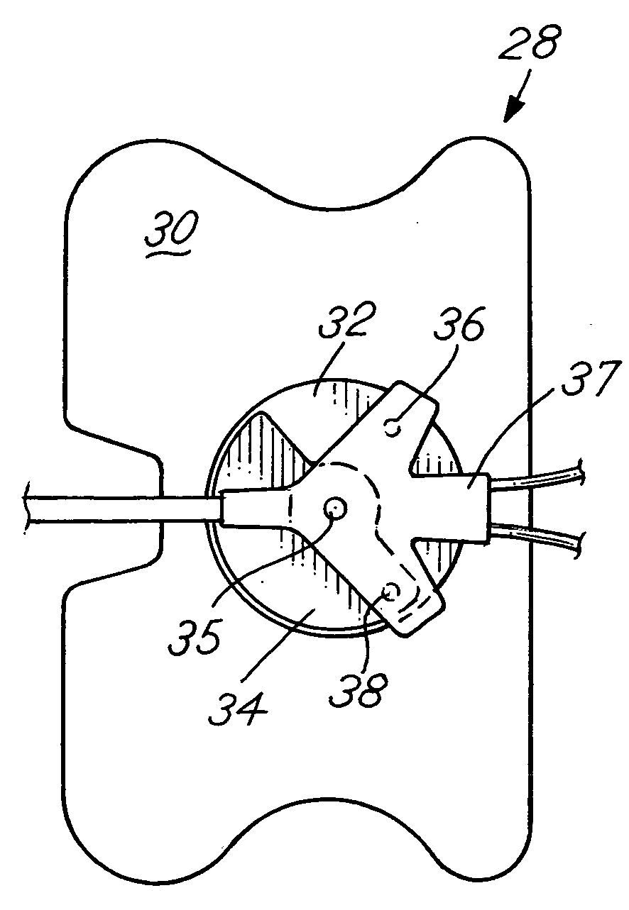 Catheter securement device