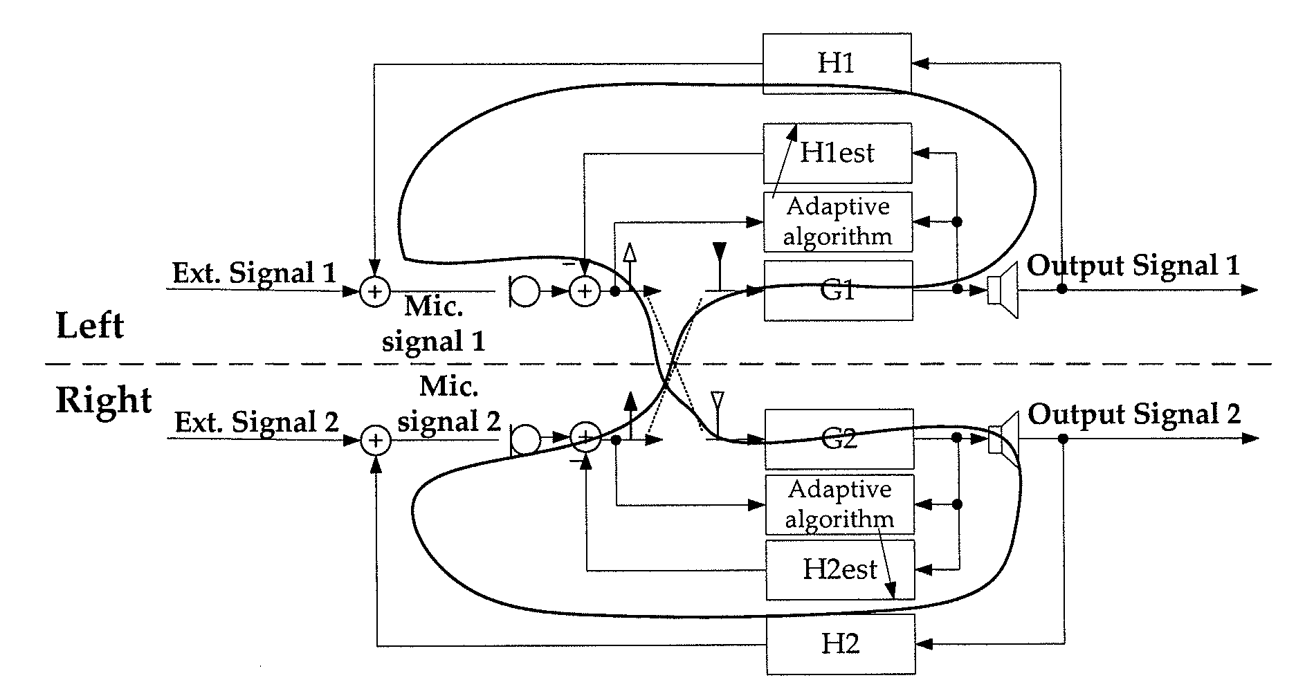 System for reducing acoustic feedback in hearing aids using inter-aural signal transmission, method and use