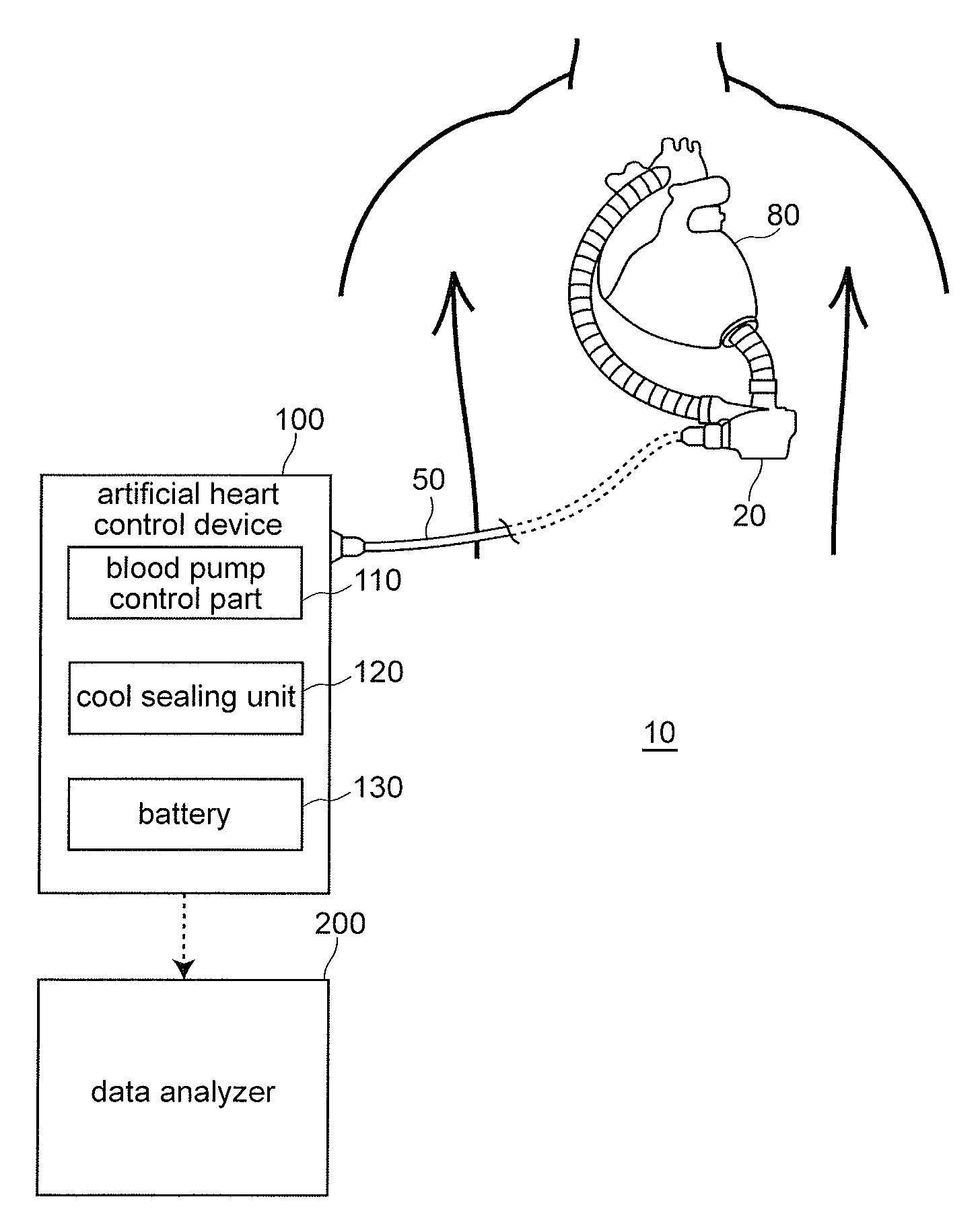 Artificial heart device