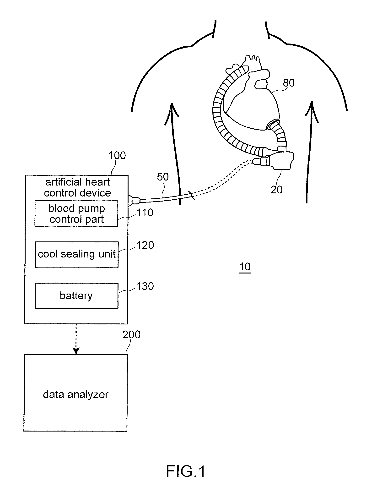 Artificial heart device