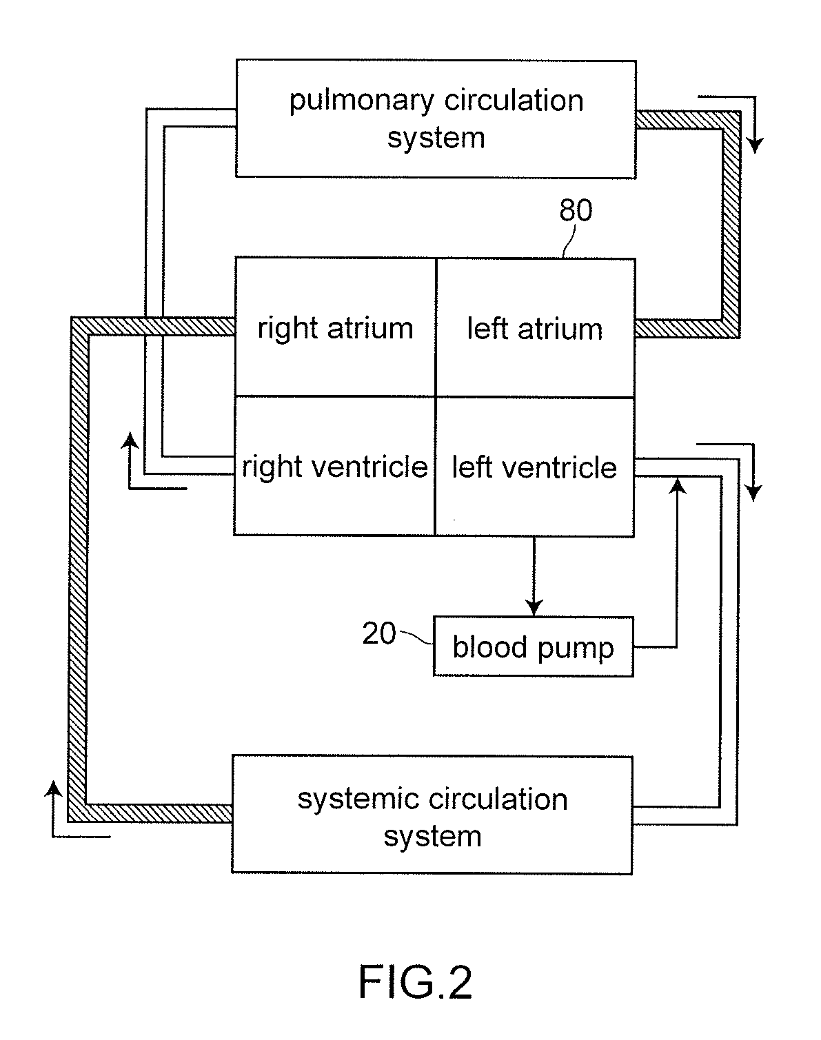 Artificial heart device