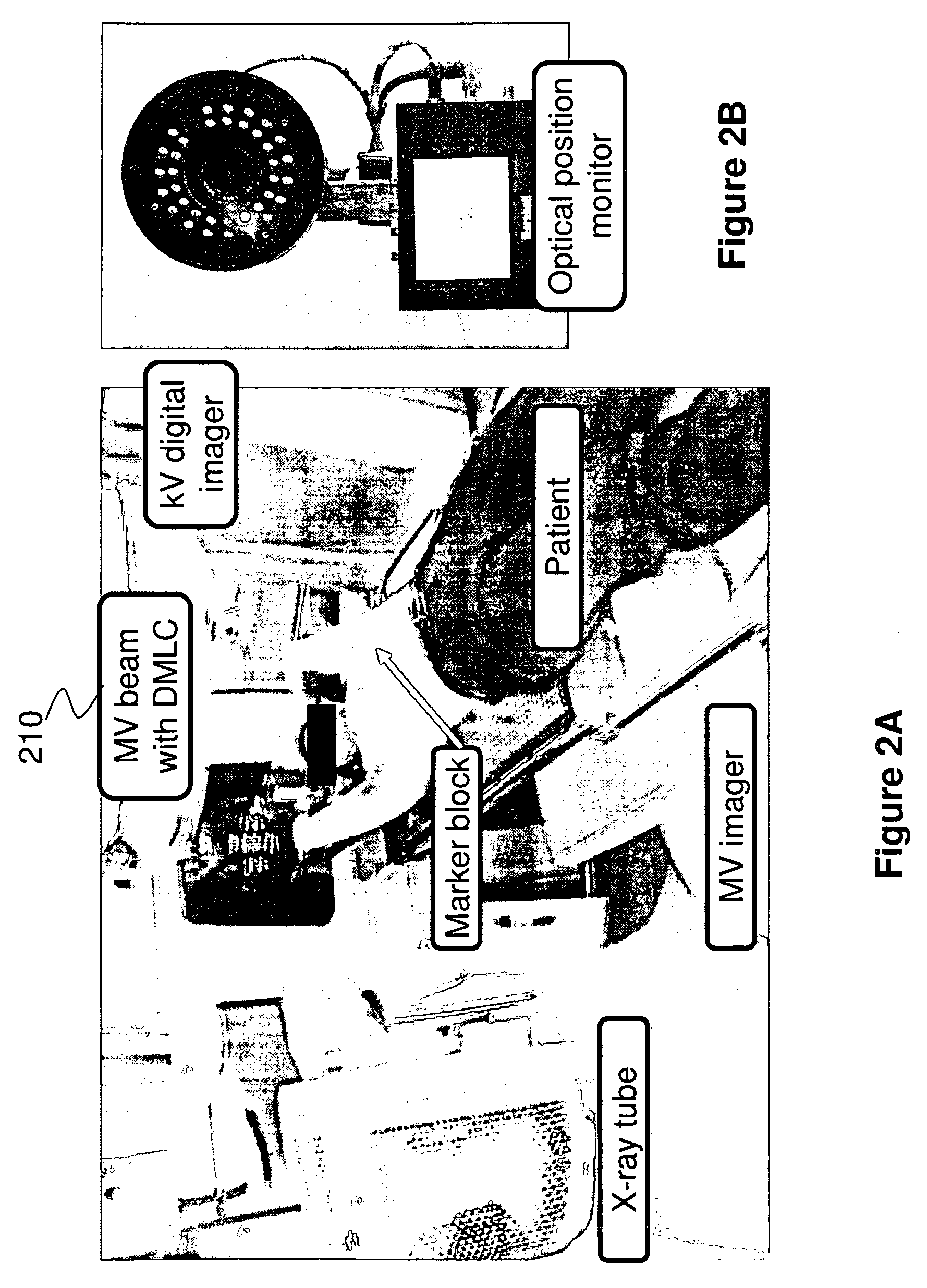 Method and apparatus for real-time target position estimation by combining x-ray and external respiratory signals