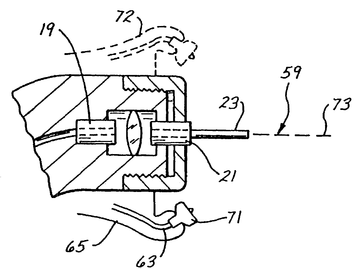 Fluid and laser system