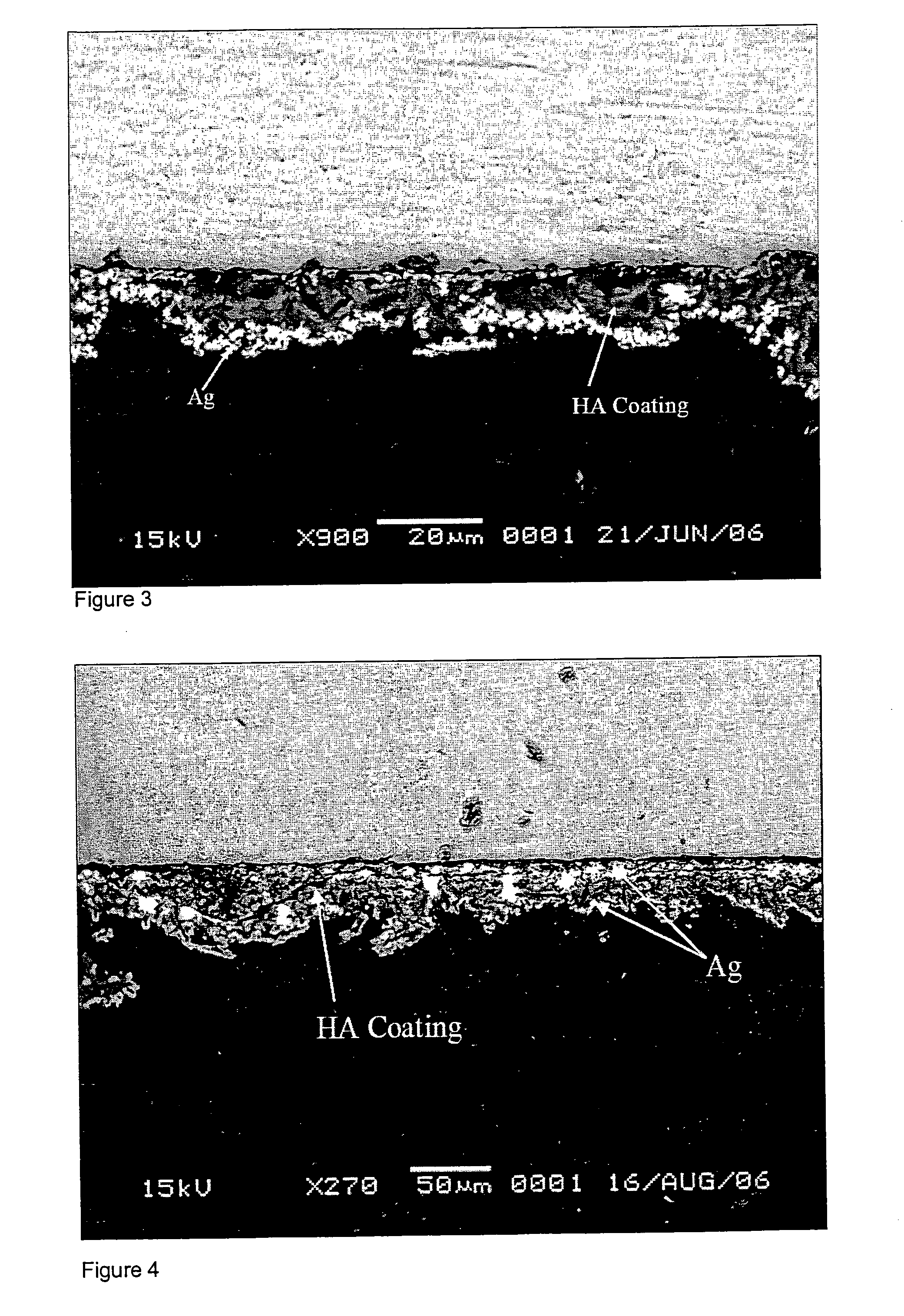 Article and a method of surface treatment of an article