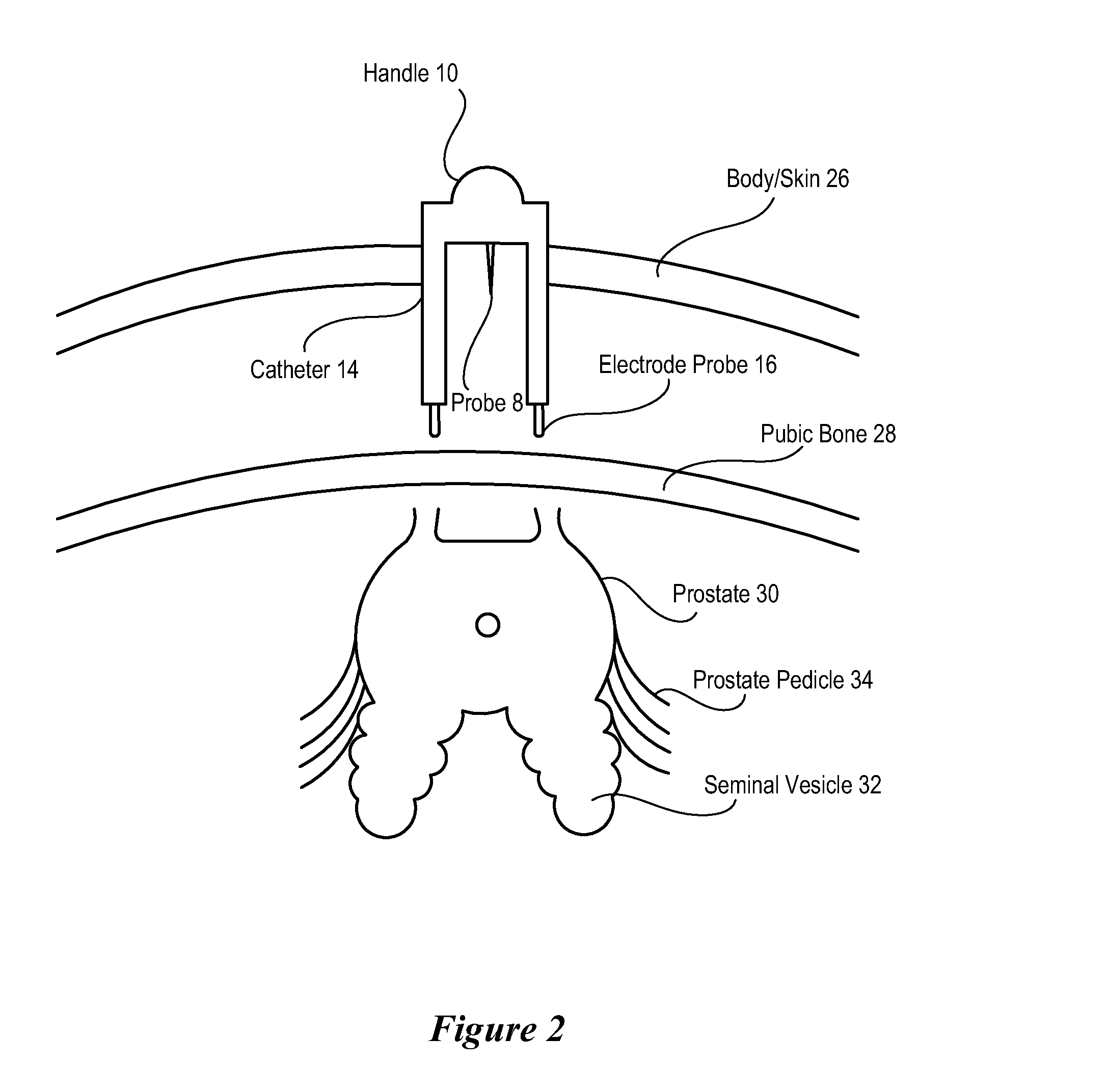 System and Method for Laparoscopic Nerve Detection