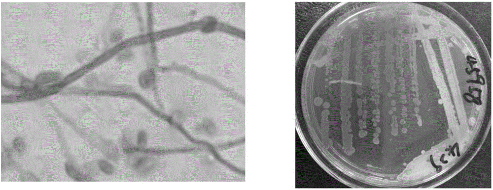 Streptomyces having inhibiting effect on Corynespora cassiicola and application of Streptomyces