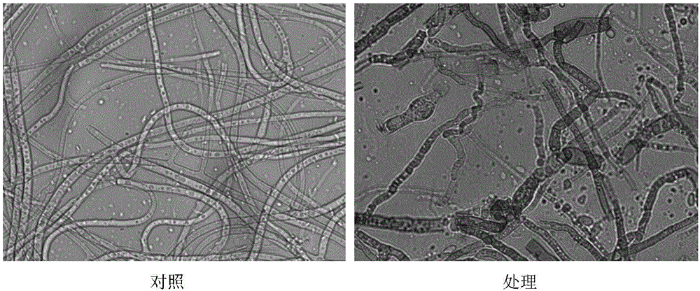 Streptomyces having inhibiting effect on Corynespora cassiicola and application of Streptomyces