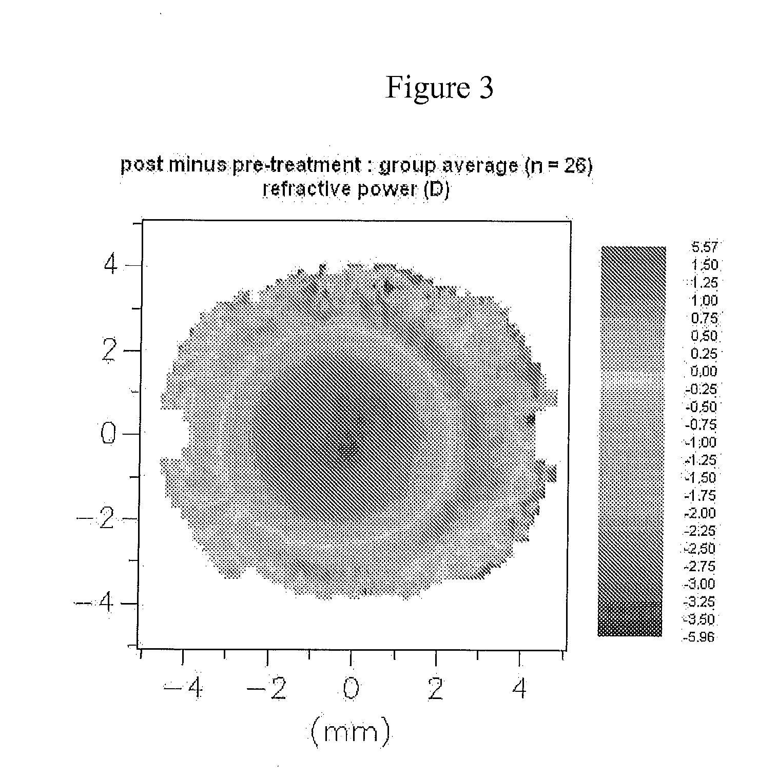 Design of myopia control ophthalmic lenses