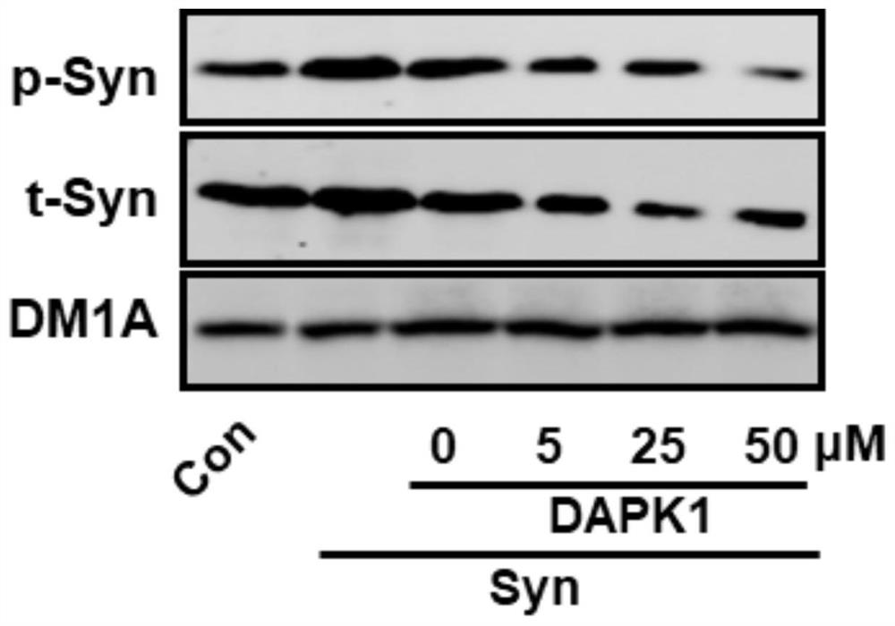 A small molecular polypeptide and its application in the preparation of drugs for preventing and treating Parkinson's syndrome