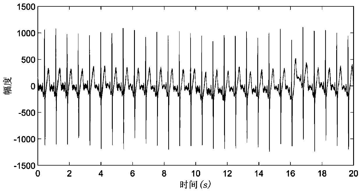 Atrial fibrillation analysis and prediction method based on cardiac mapping excitation sequence diagram