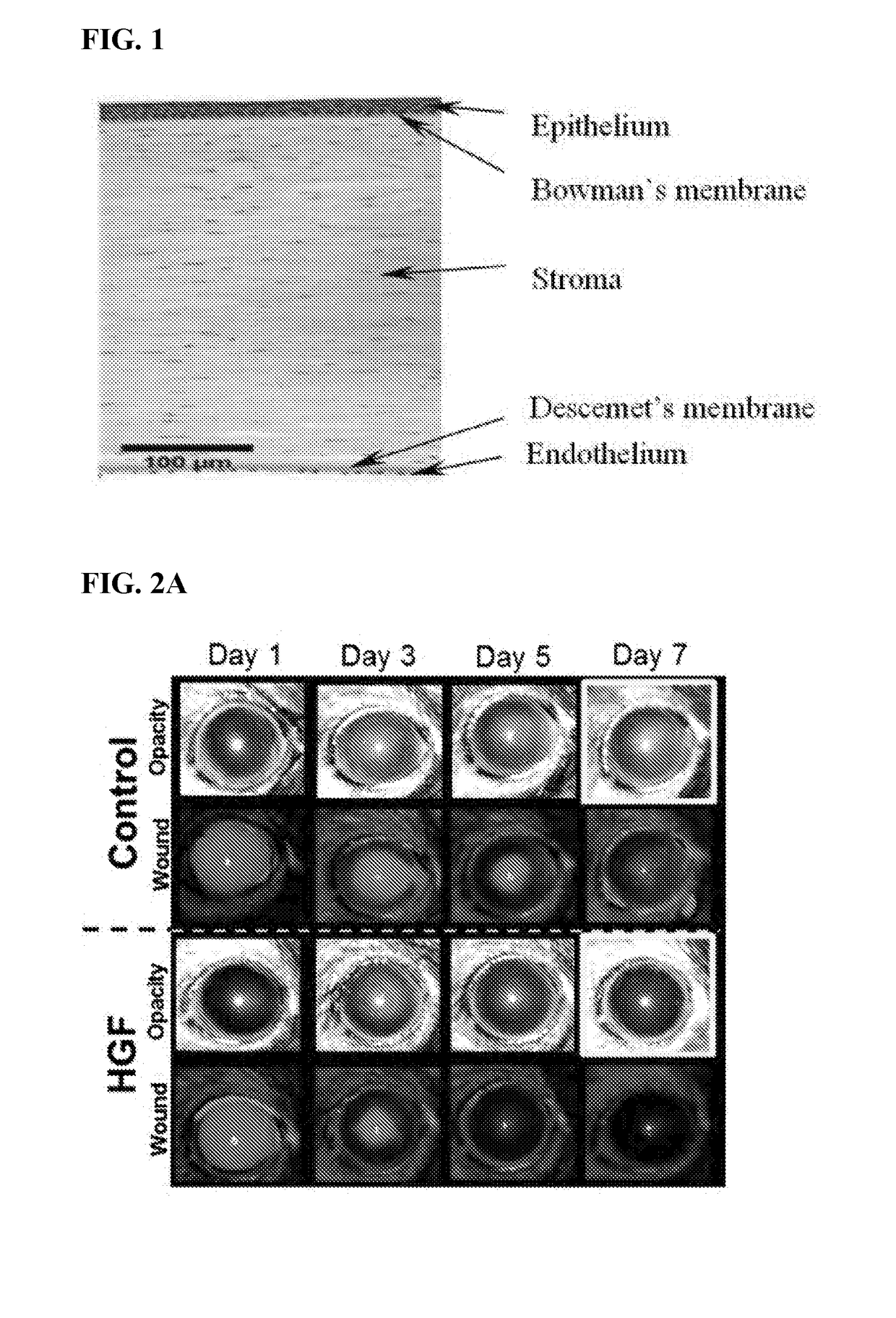 Compositions and methods for prevention and treatment of corneal haze and scarring