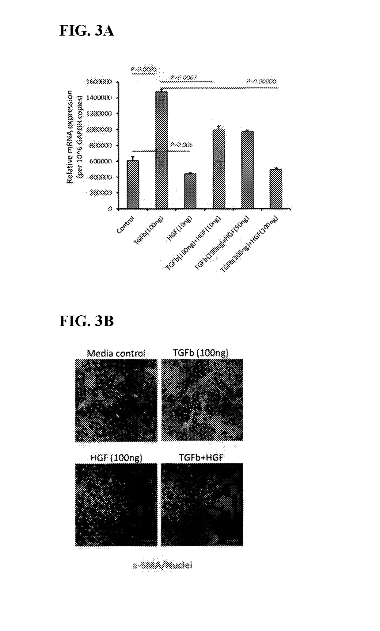 Compositions and methods for prevention and treatment of corneal haze and scarring