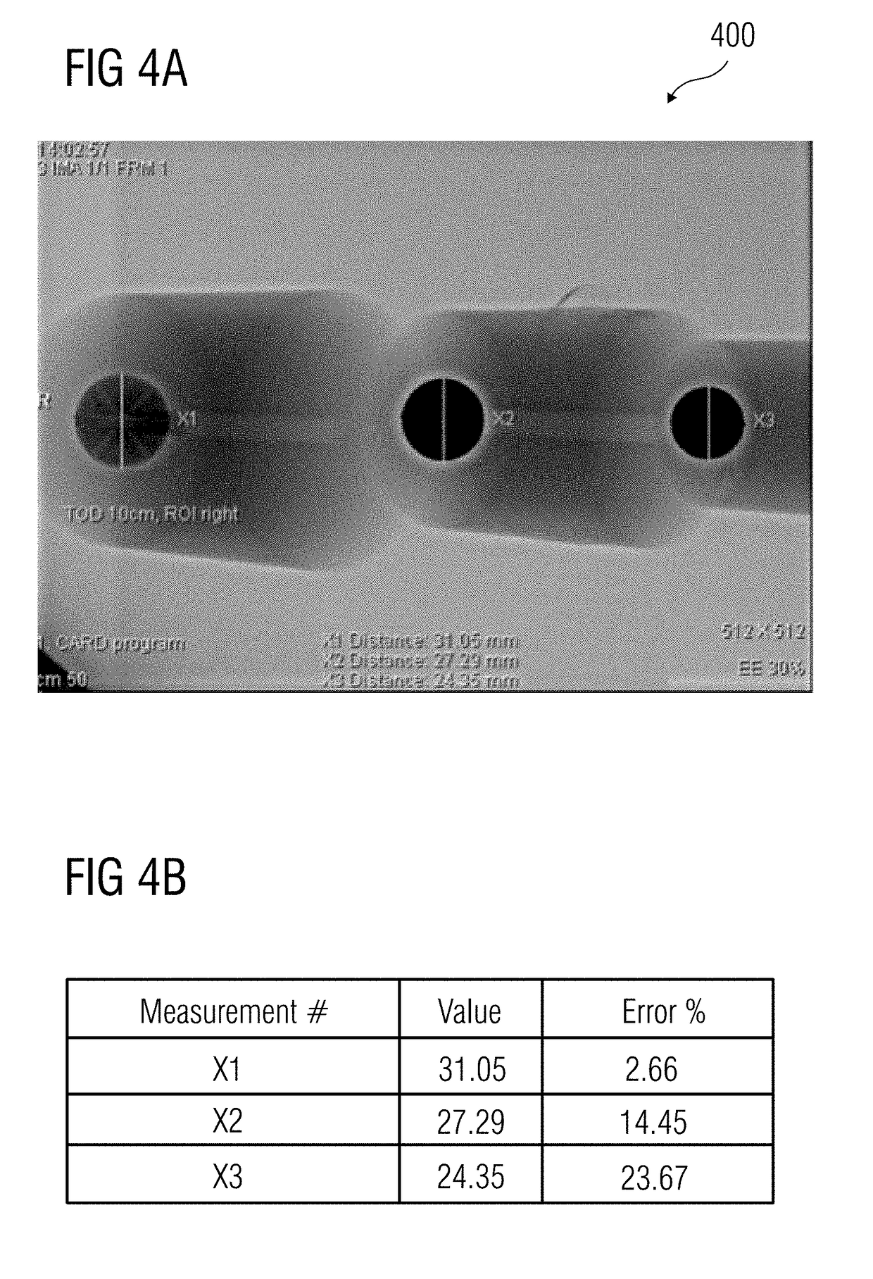 Method and system for obtaining a true shape of objects in a medical image