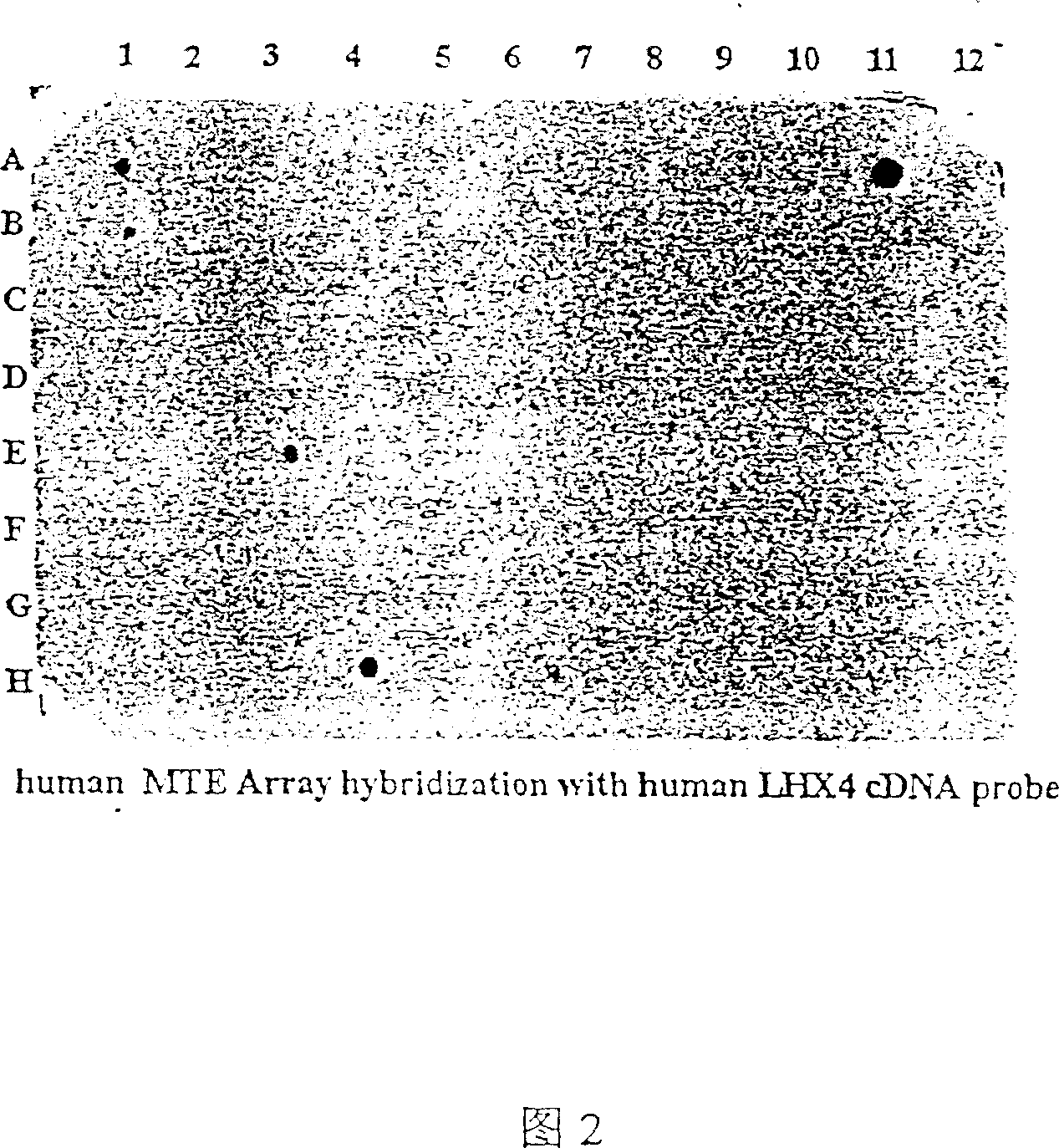 Use of human homology cassette gene LHX4 in preparing medicine for treating phaeochromocytoma