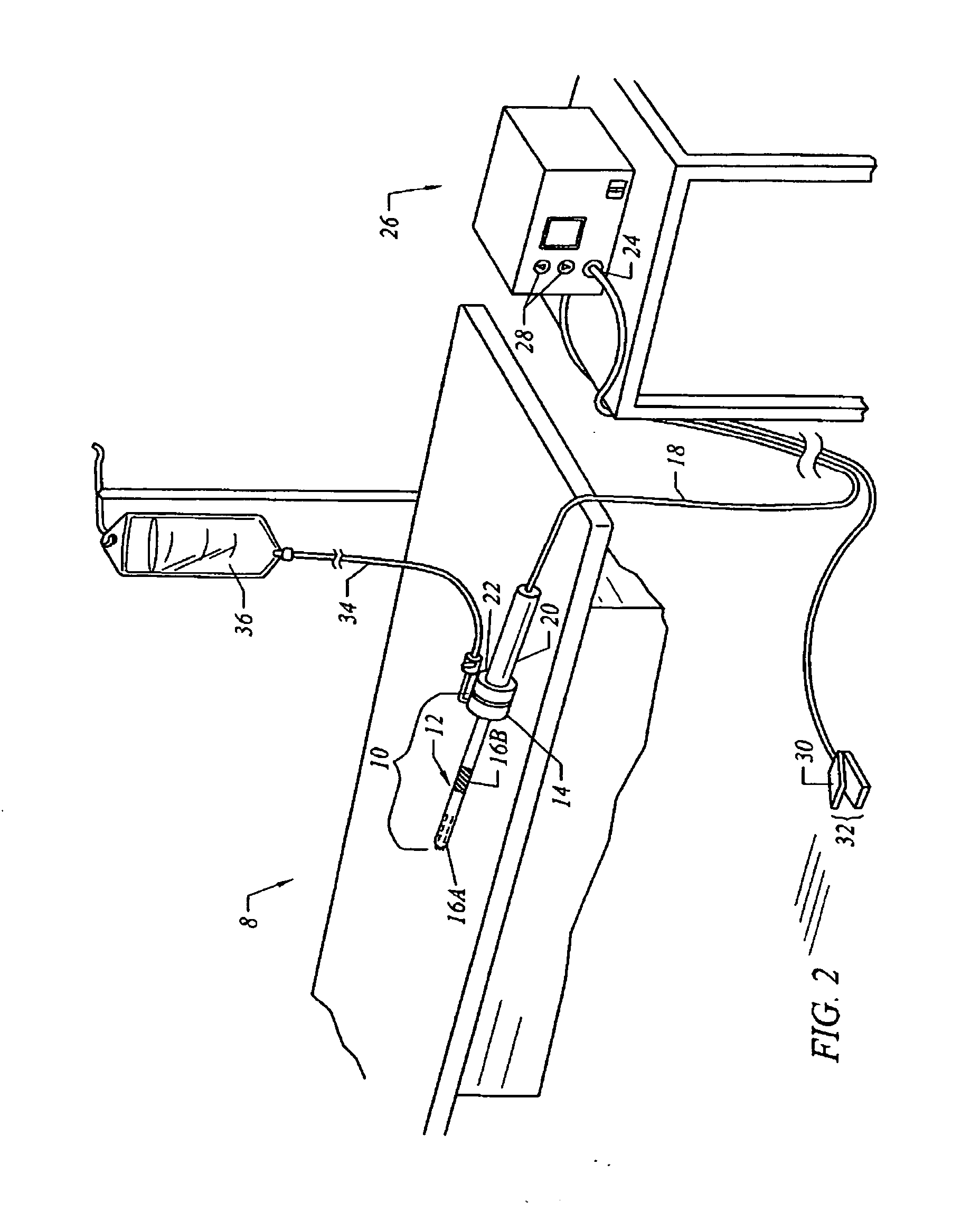 Electrosurgical method and system for treating foot ulcer