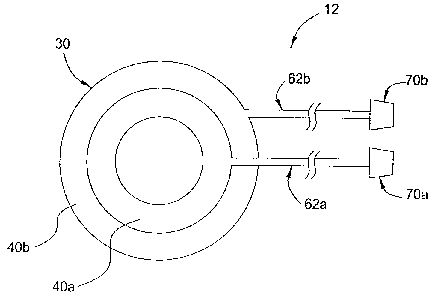 Apparatus and methods for minimally invasive obesity treatment