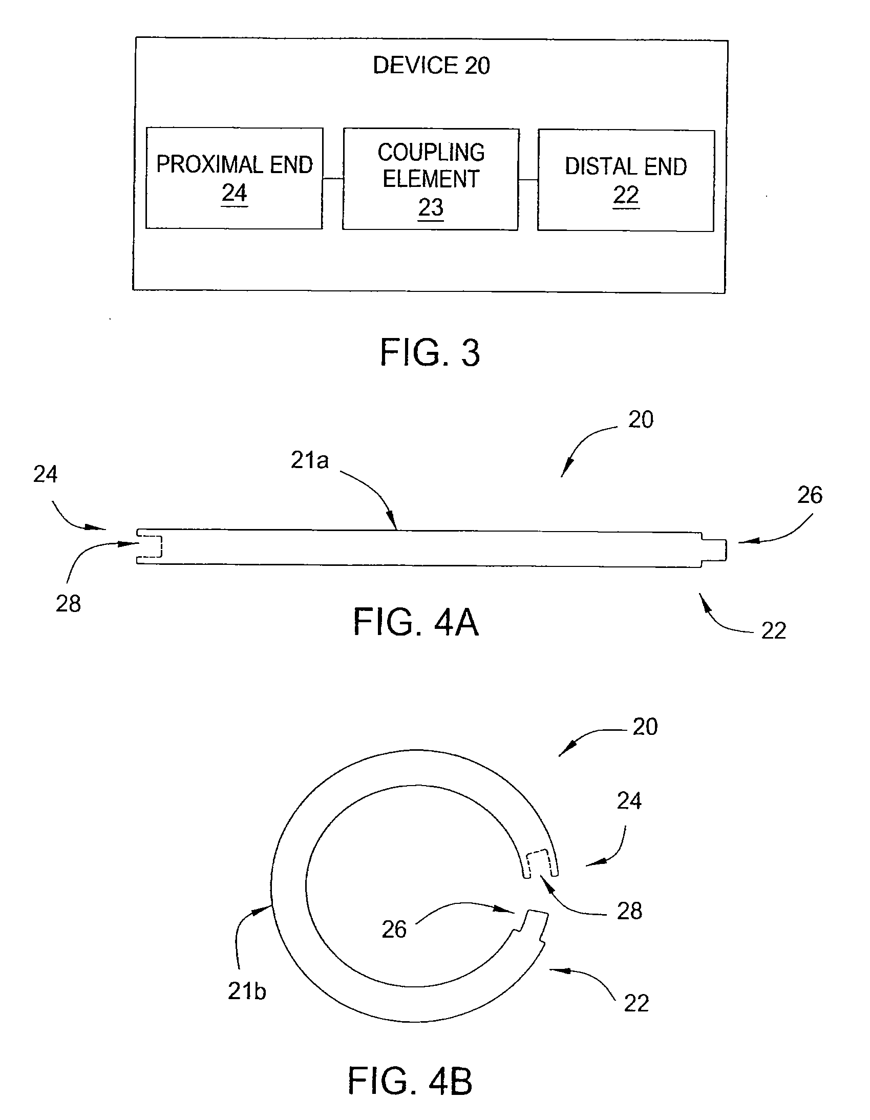 Apparatus and methods for minimally invasive obesity treatment