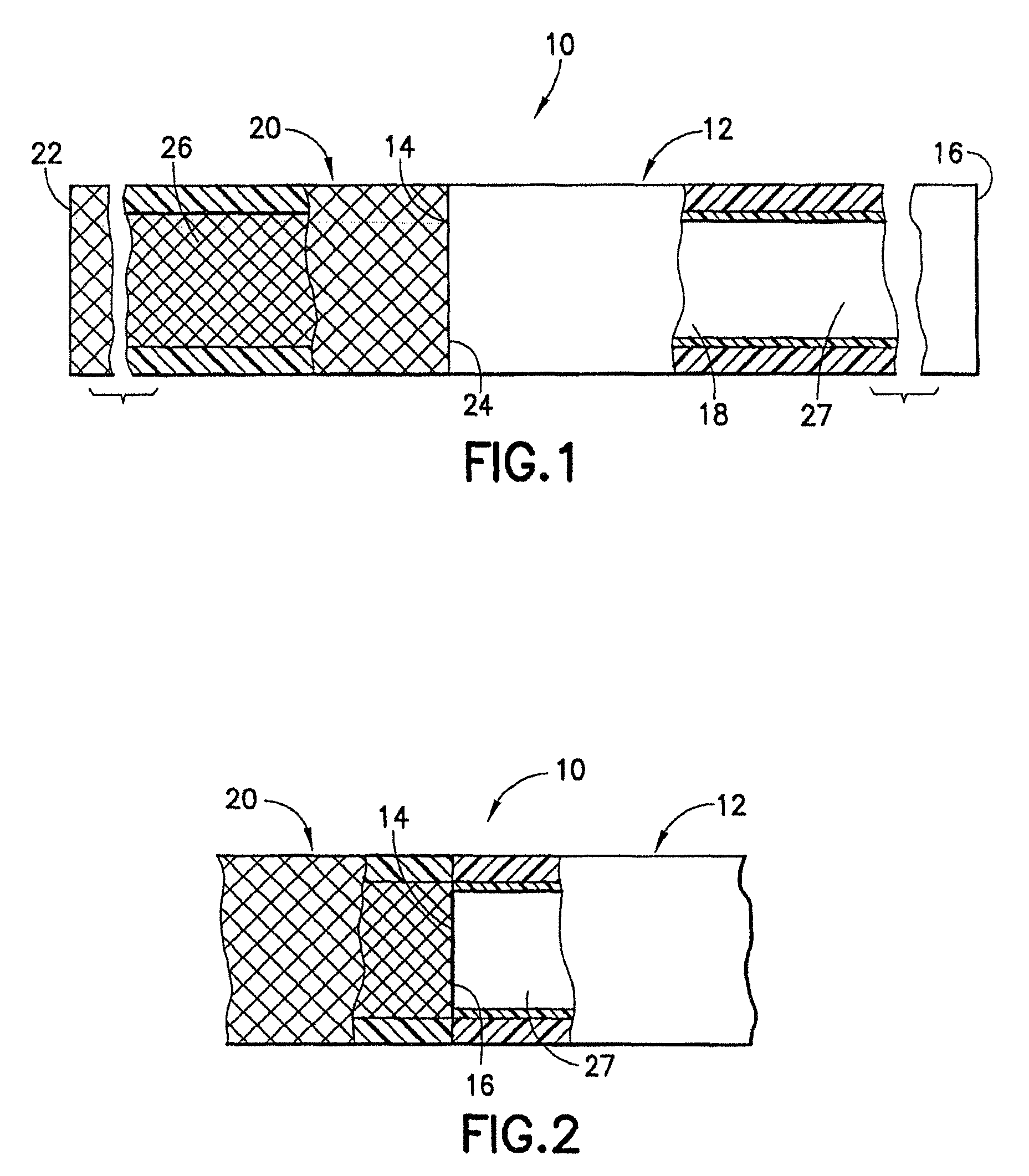 Stent/graft assembly