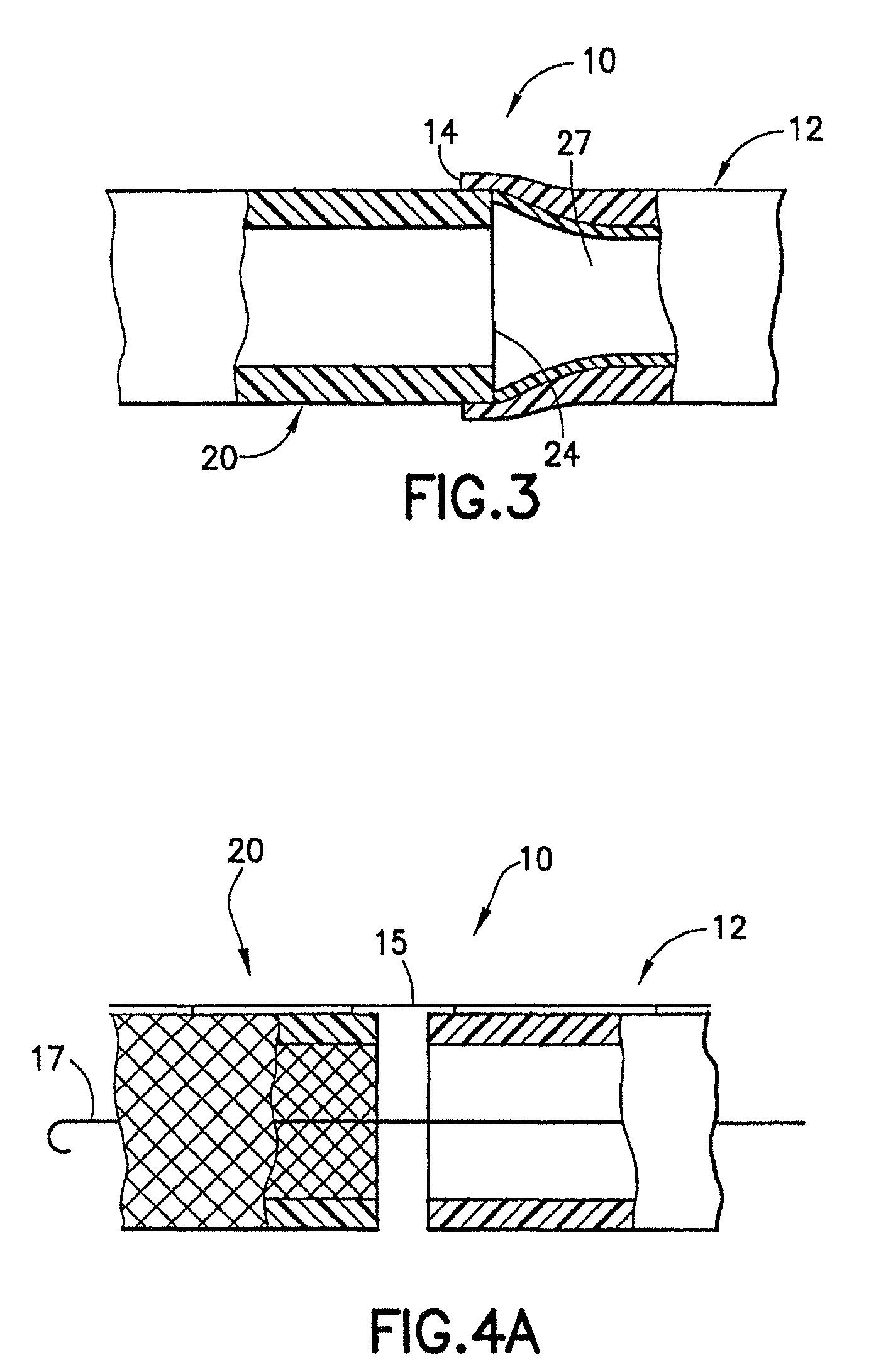 Stent/graft assembly