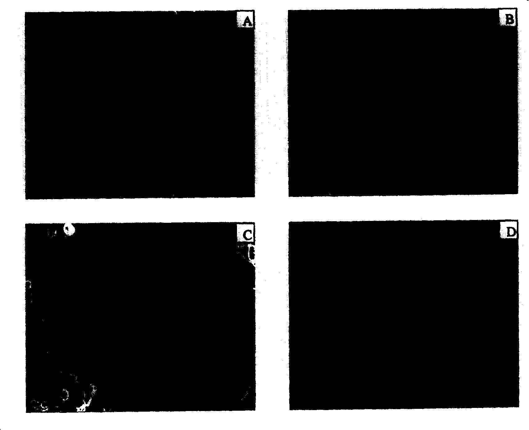 Surface activating method of medical metal material