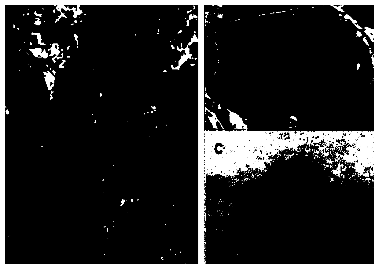 Extraction method for dalbergia sissoo and application of extracts in anti-tumor drugs