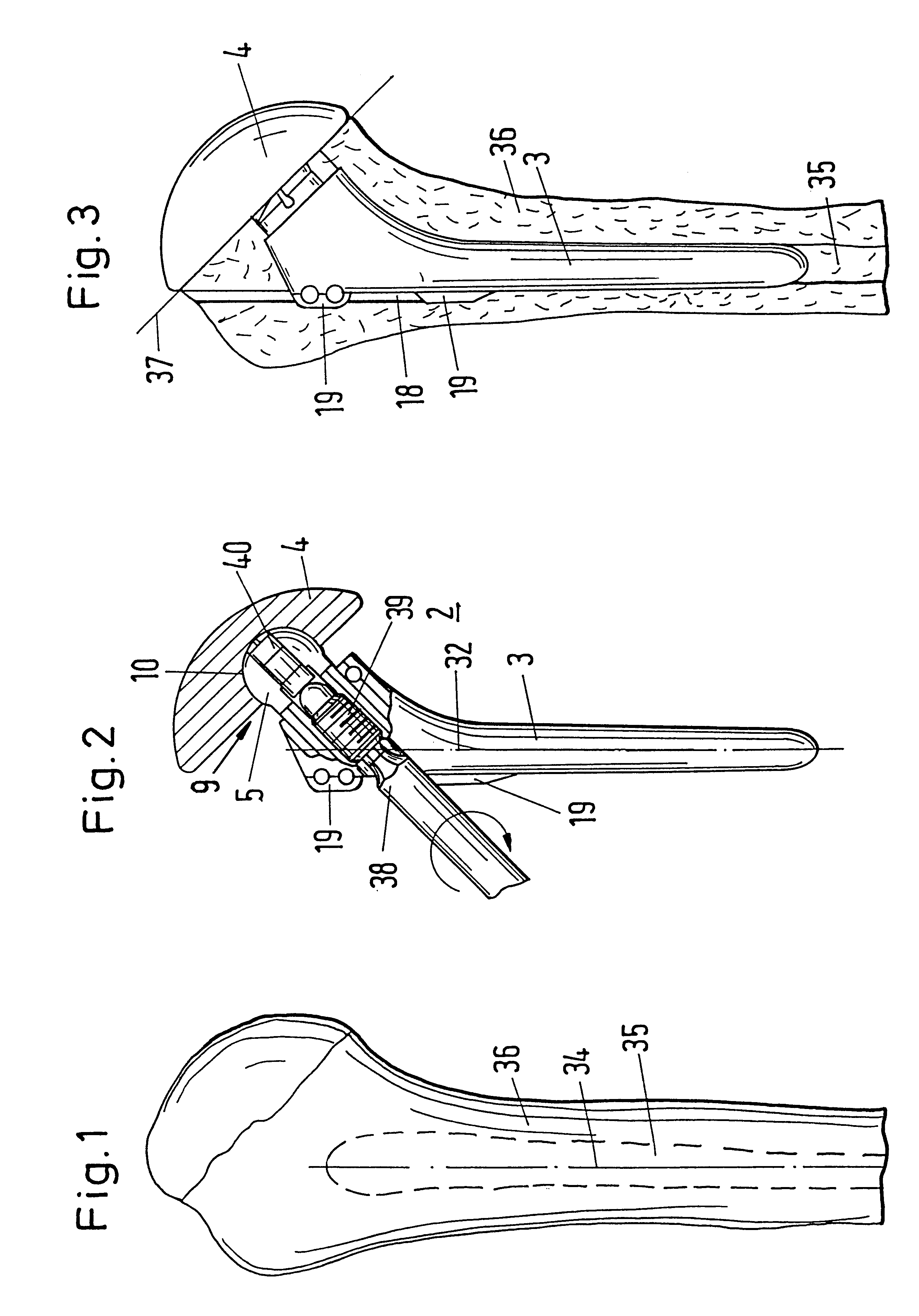 Modular system for shaft prostheses