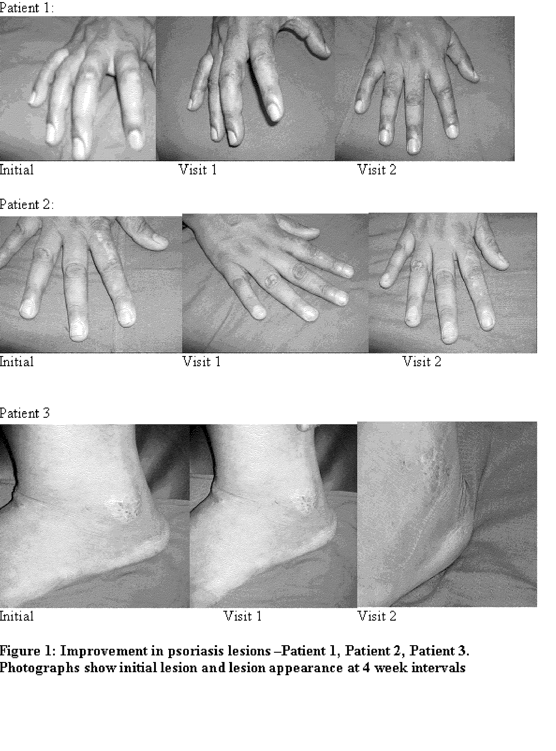 [Compositions and methods for the management of hyperproliferative dermatological conditions]