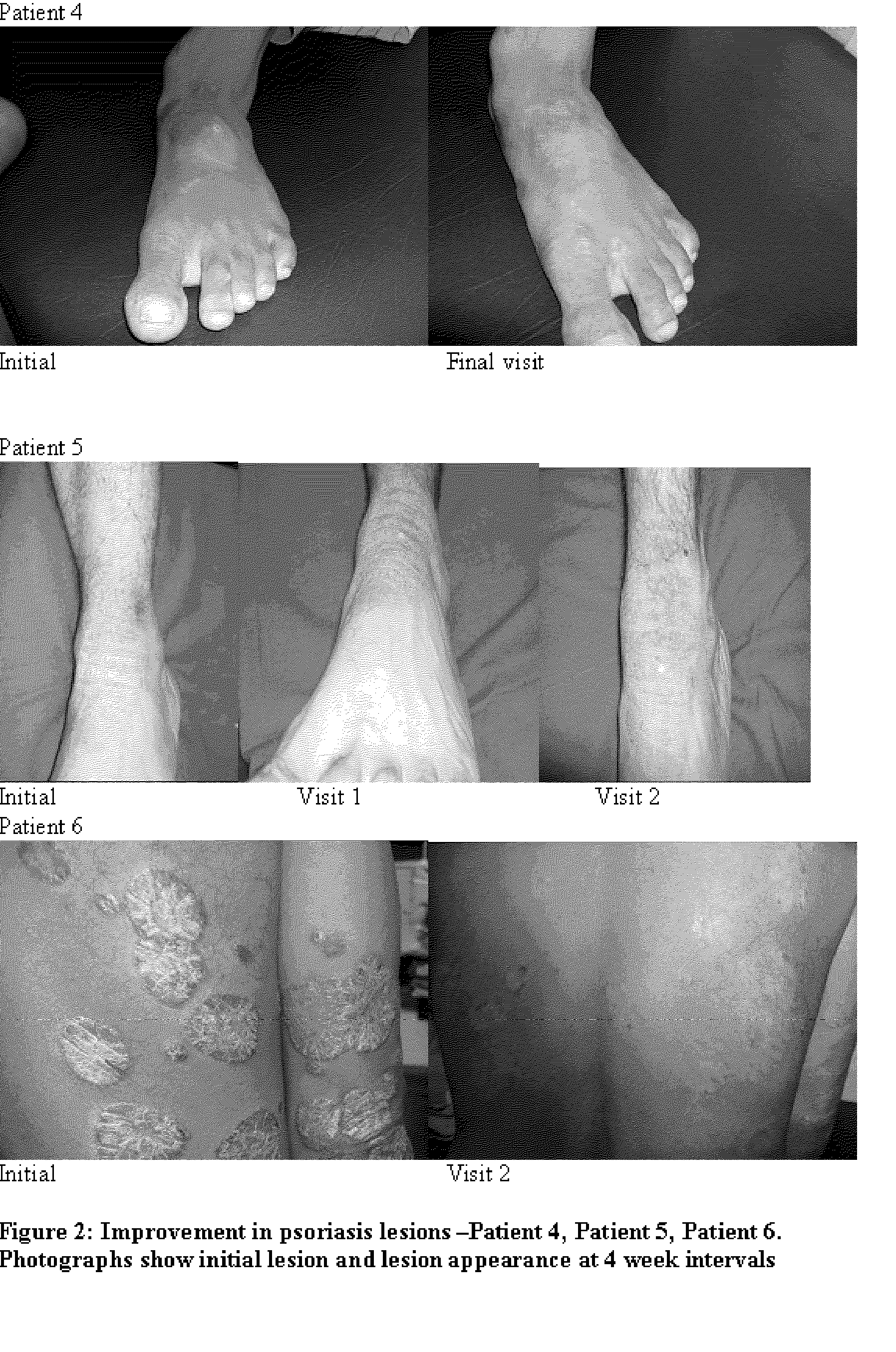 [Compositions and methods for the management of hyperproliferative dermatological conditions]