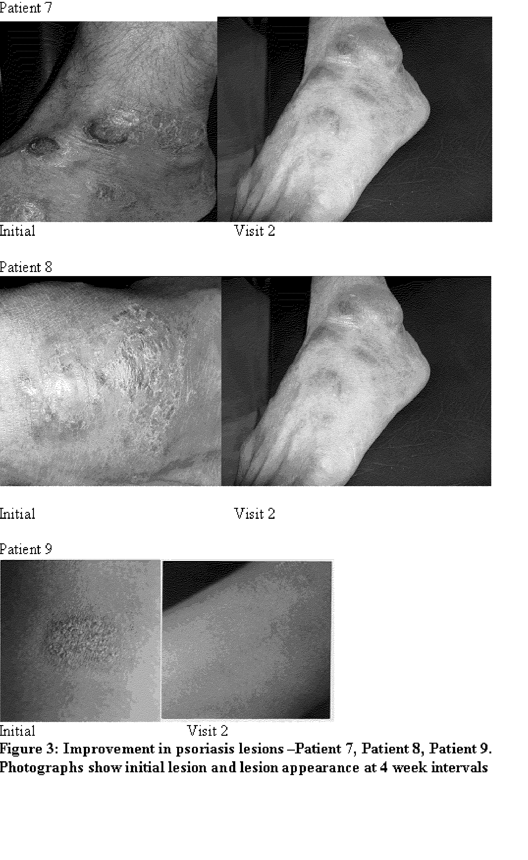 [Compositions and methods for the management of hyperproliferative dermatological conditions]