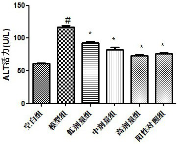 Application of bifidobacterium lactis JYBR-190 in product for removing heavy metals in body