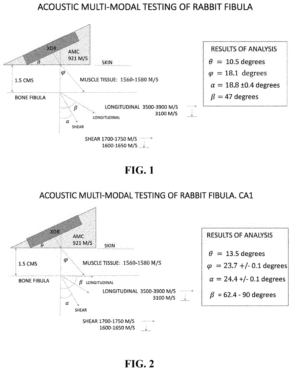 Ultrasound stimulation of musculo-skeletal tissue structures