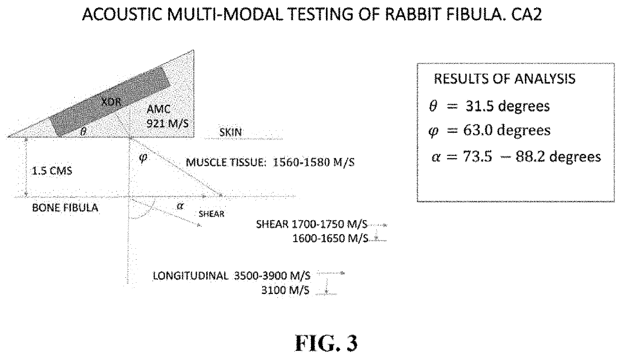 Ultrasound stimulation of musculo-skeletal tissue structures