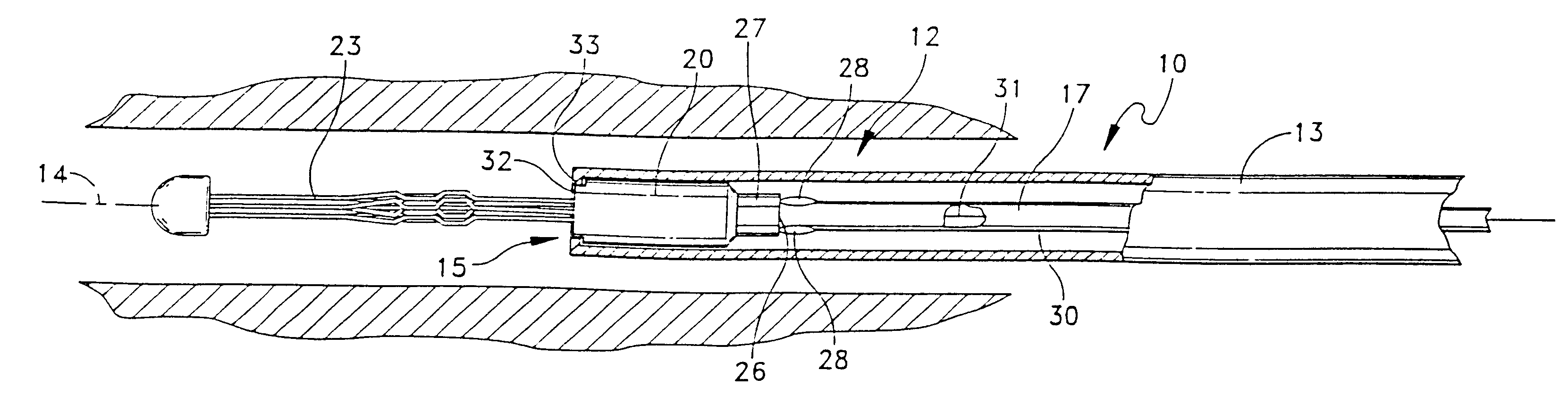 Vena cava delivery system