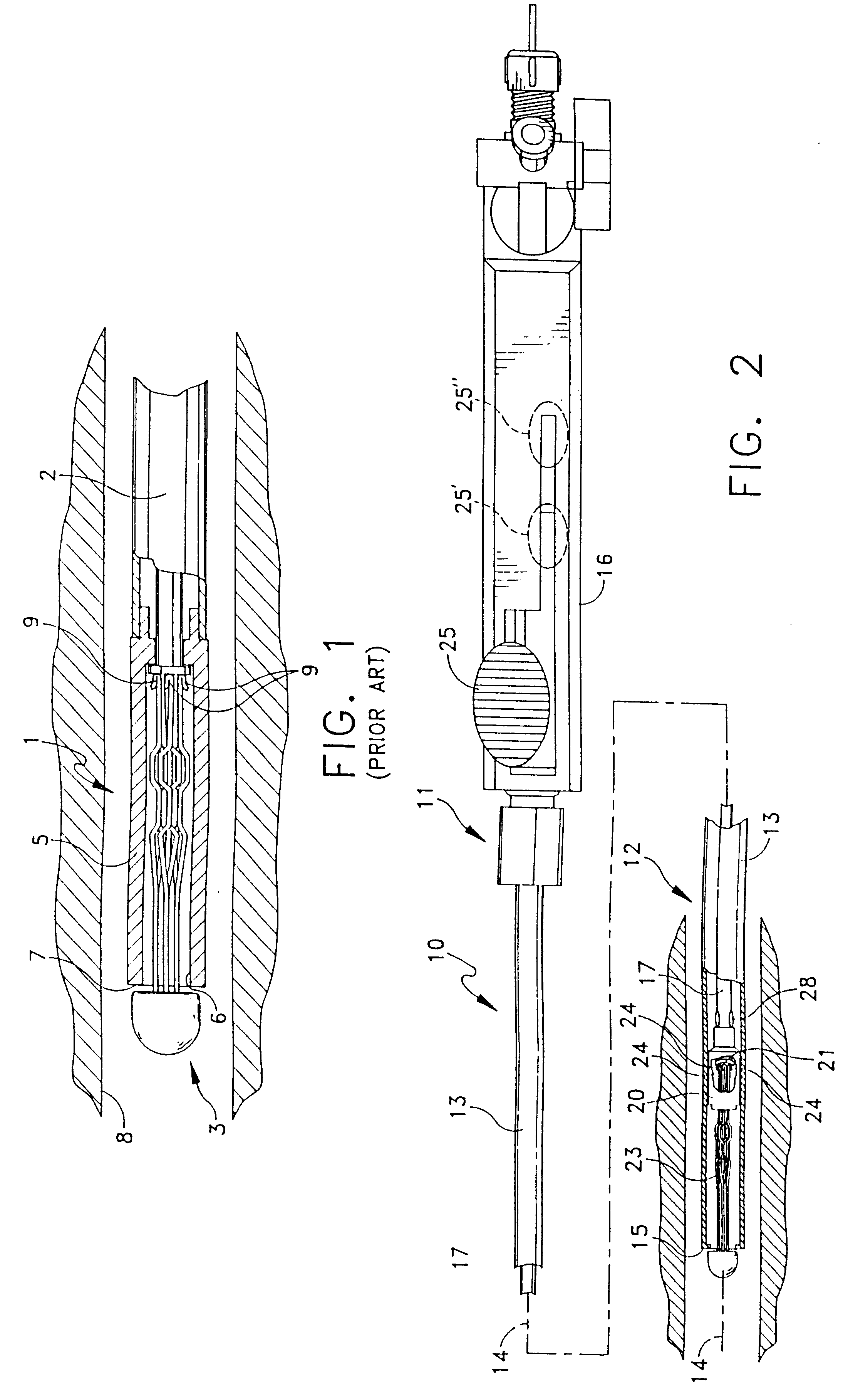 Vena cava delivery system