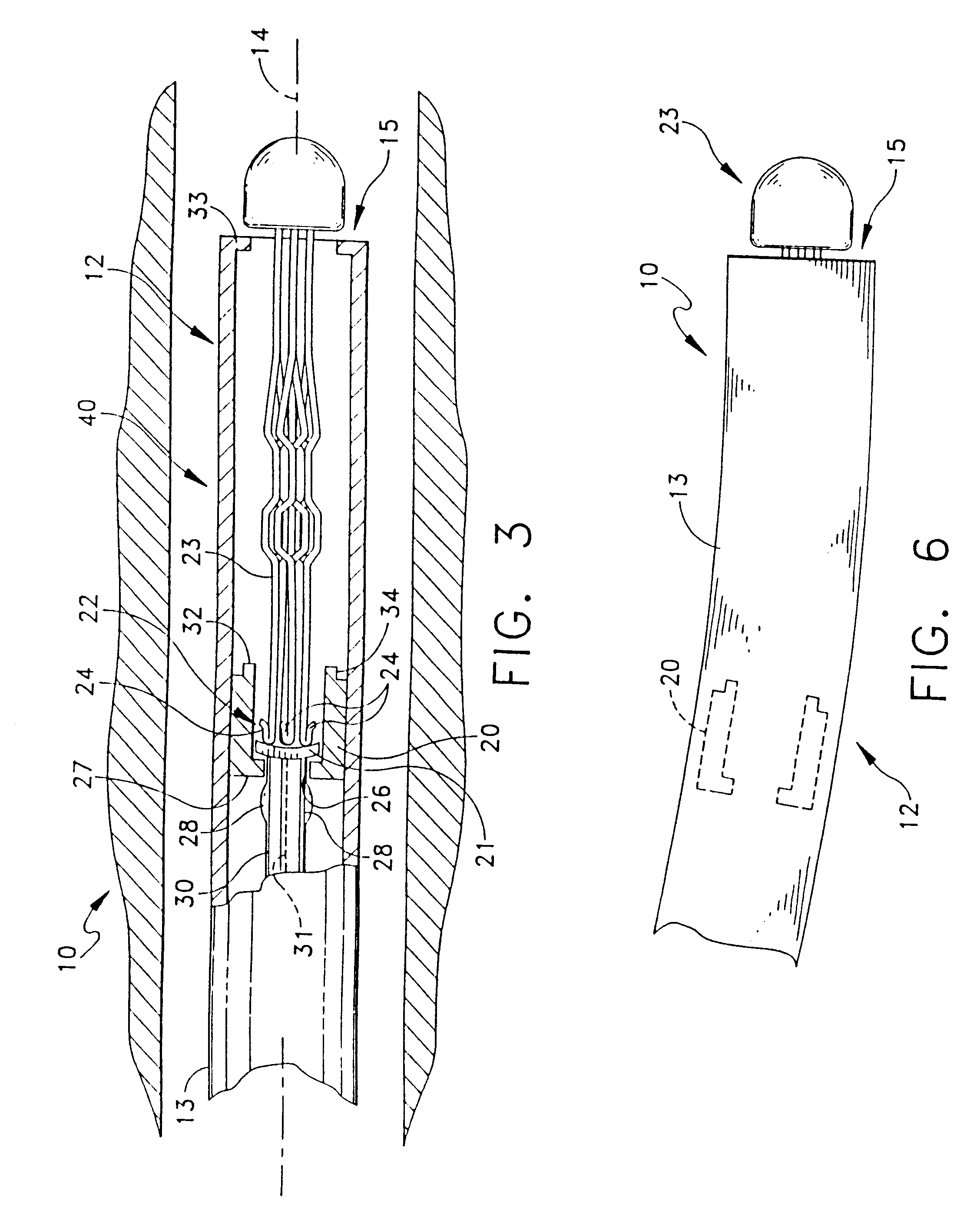 Vena cava delivery system