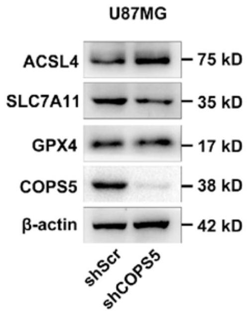 Method for improving curative effect of temozolomide in glioblastoma