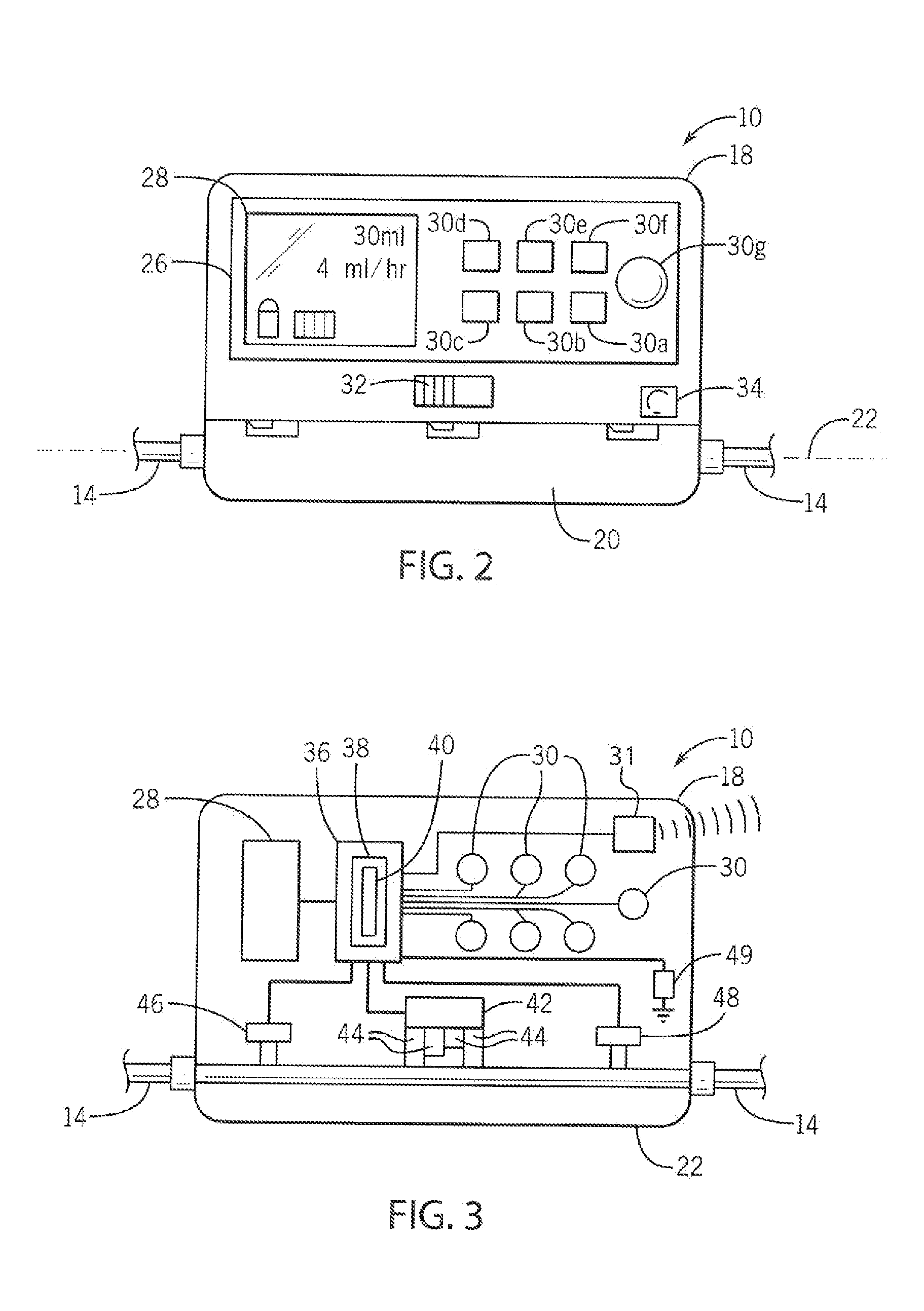 Medical Pump System For Improved Pain Management