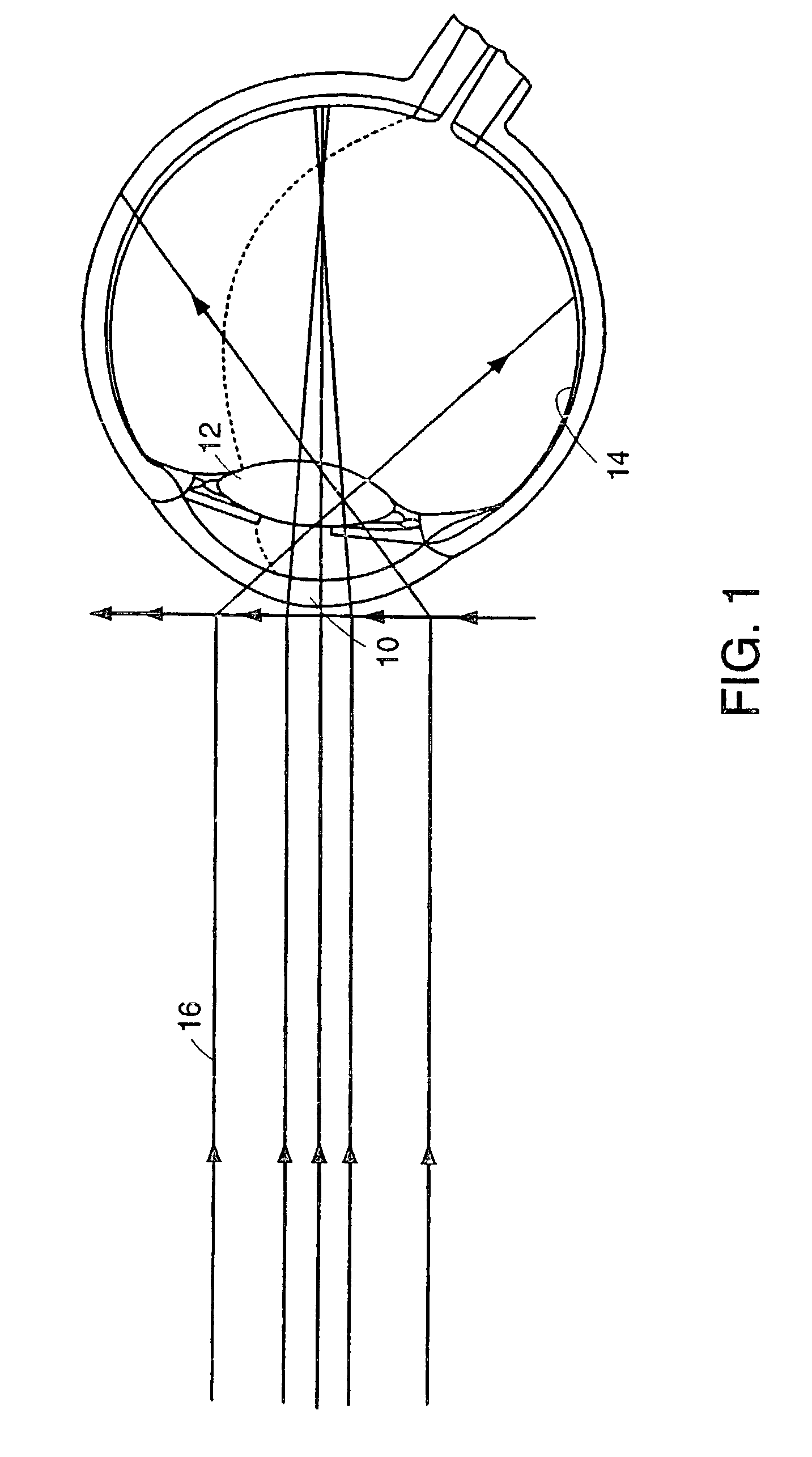 Method for preventing myopia progression through identification and correction of optical aberrations