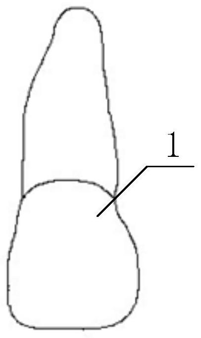 Fixing device, composite structure and manufacturing method for temporary implant restoration